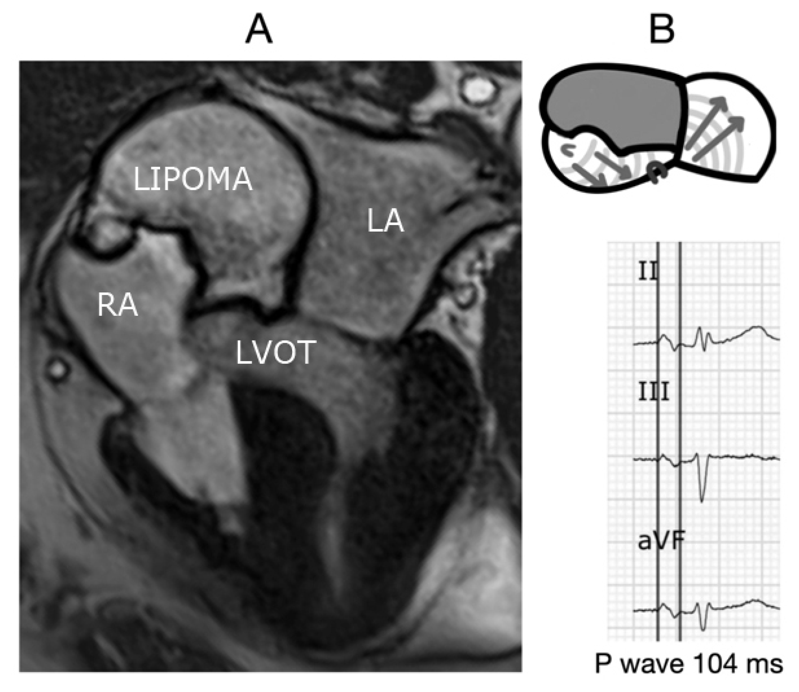 Hearts 02 00033 g011