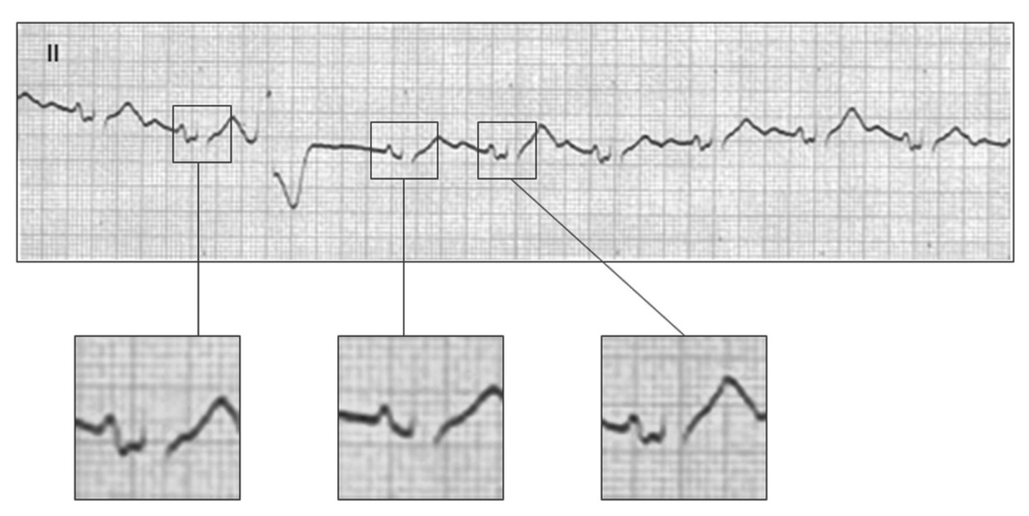 Hearts 02 00033 g012