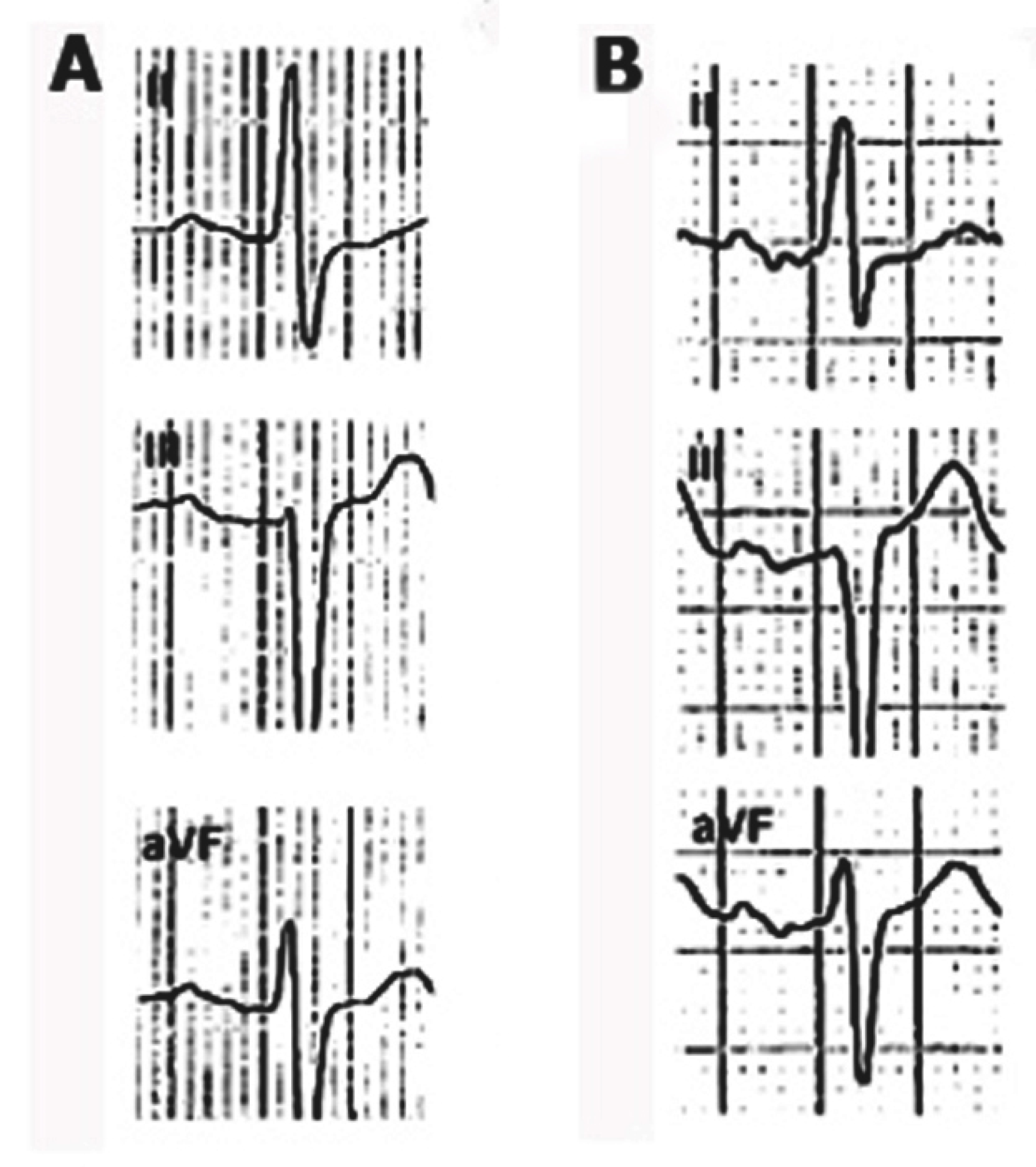 Hearts 02 00033 g013
