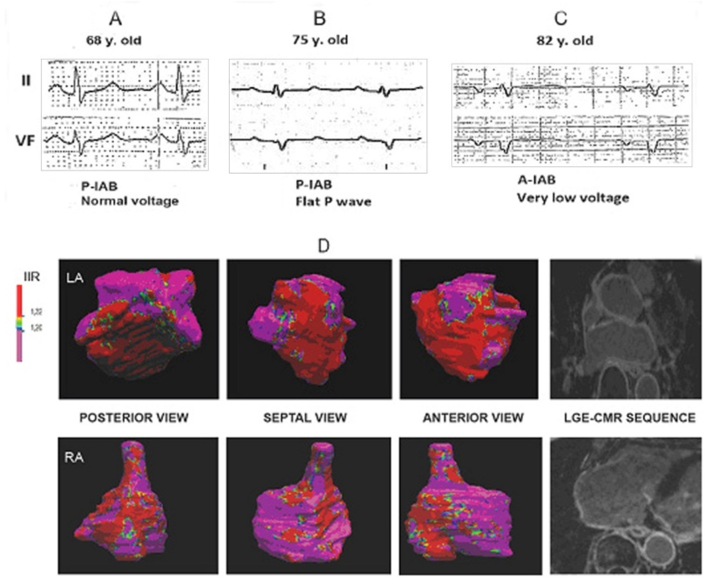 Hearts 02 00033 g014