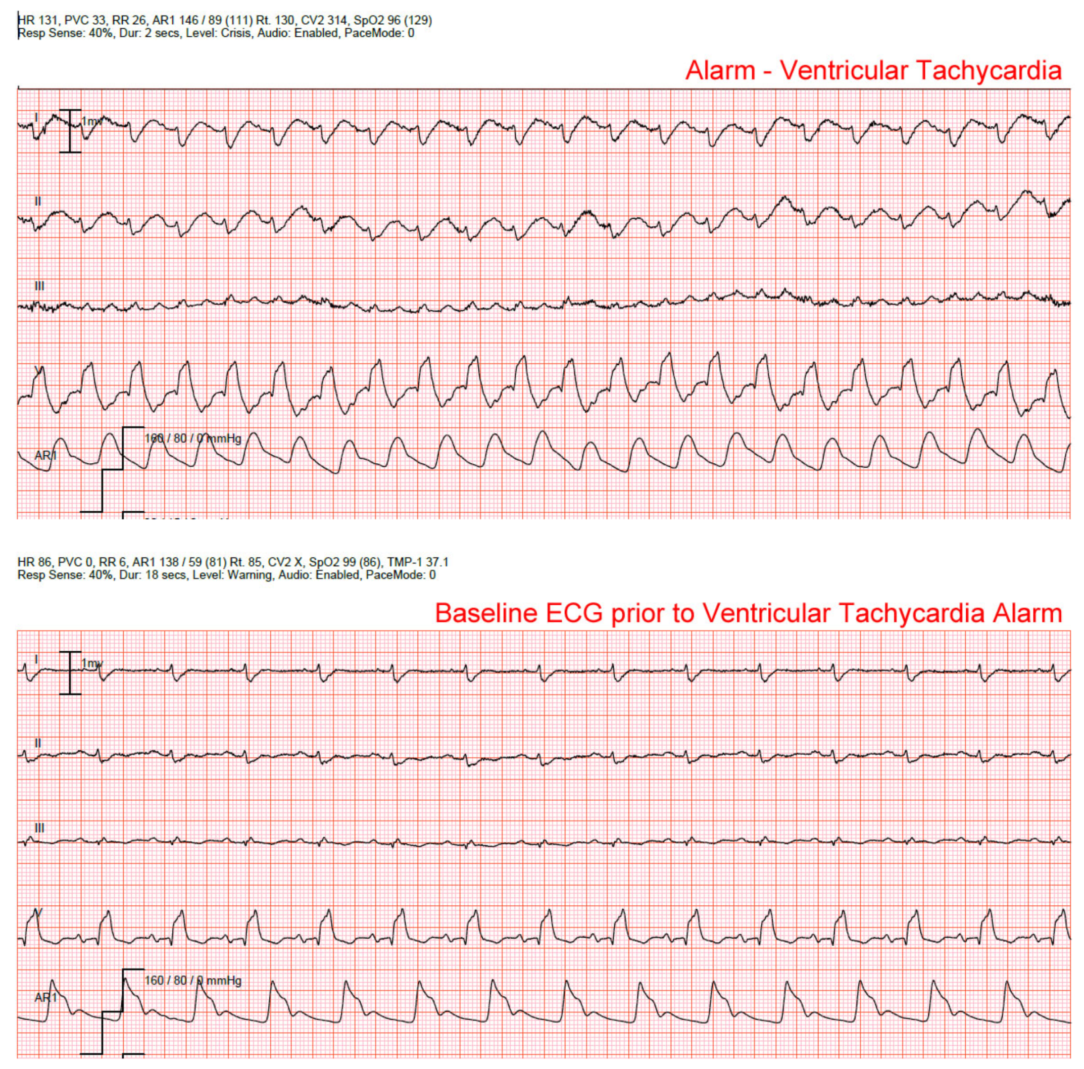 Hearts 02 00036 g002