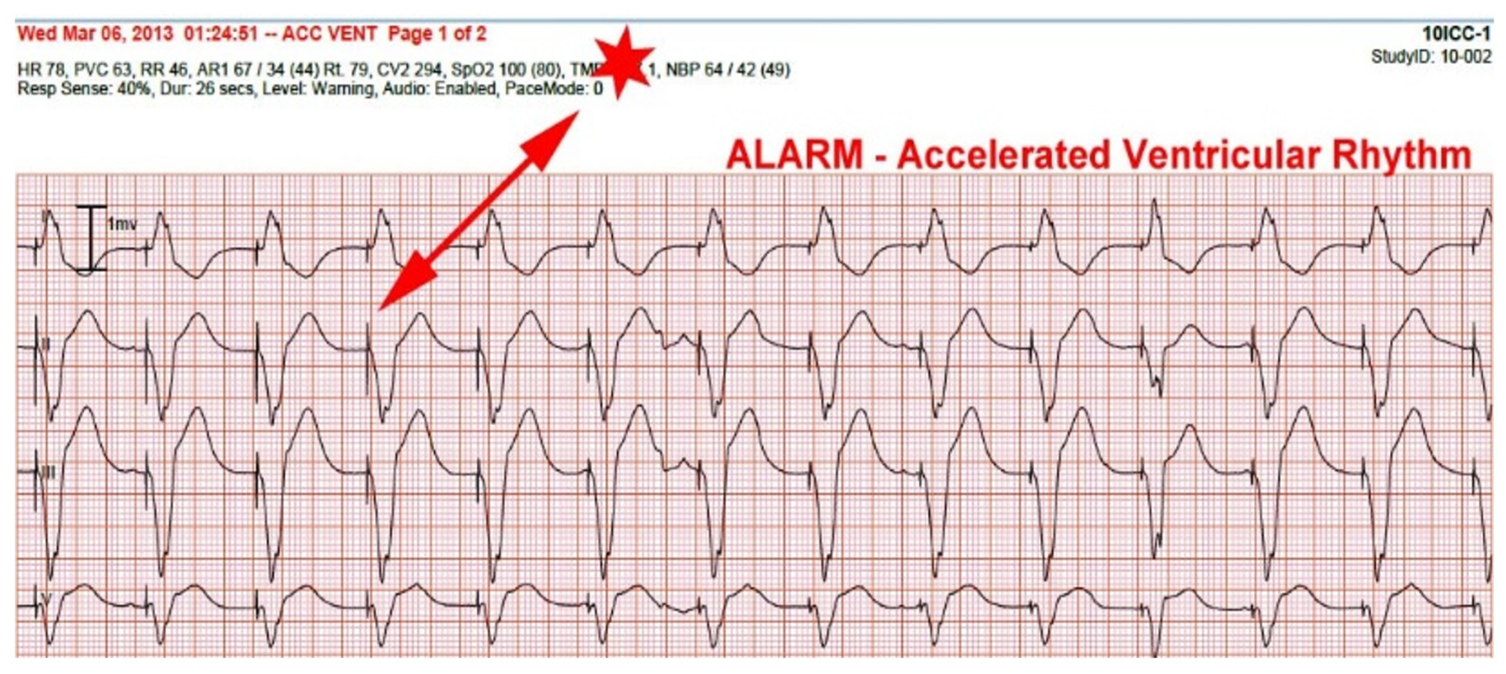 Hearts 02 00036 g003