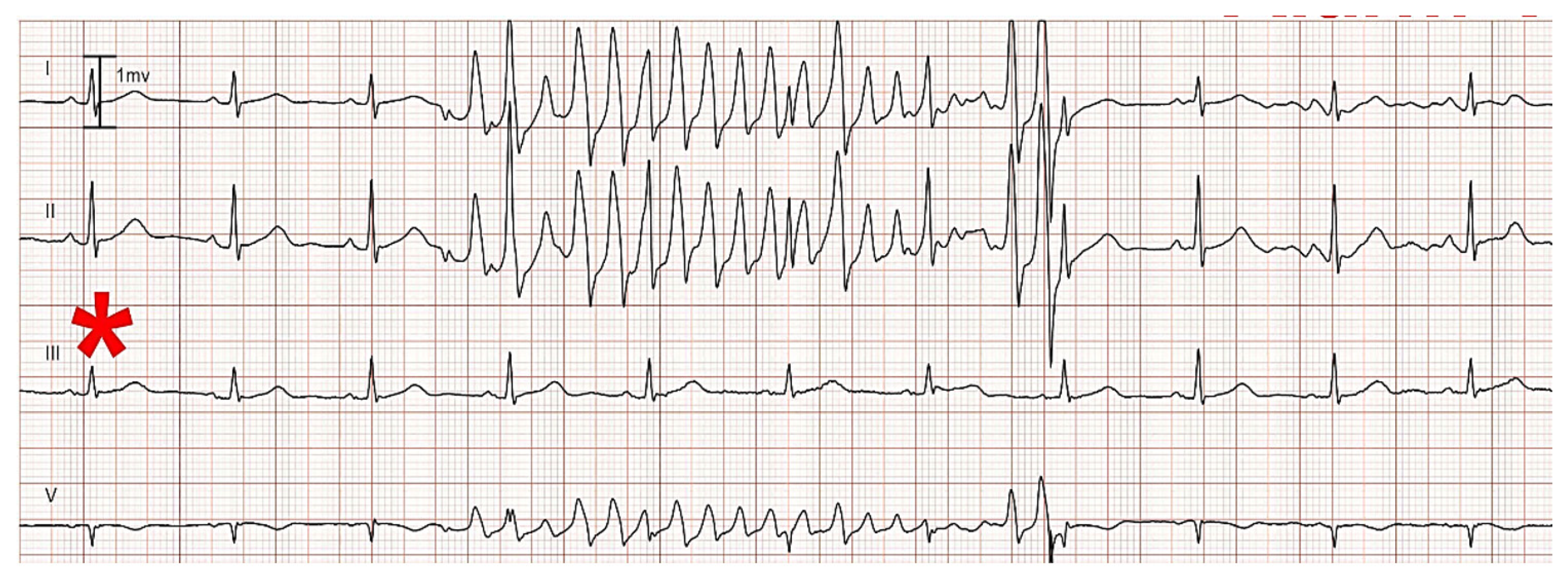 Hearts 02 00036 g005
