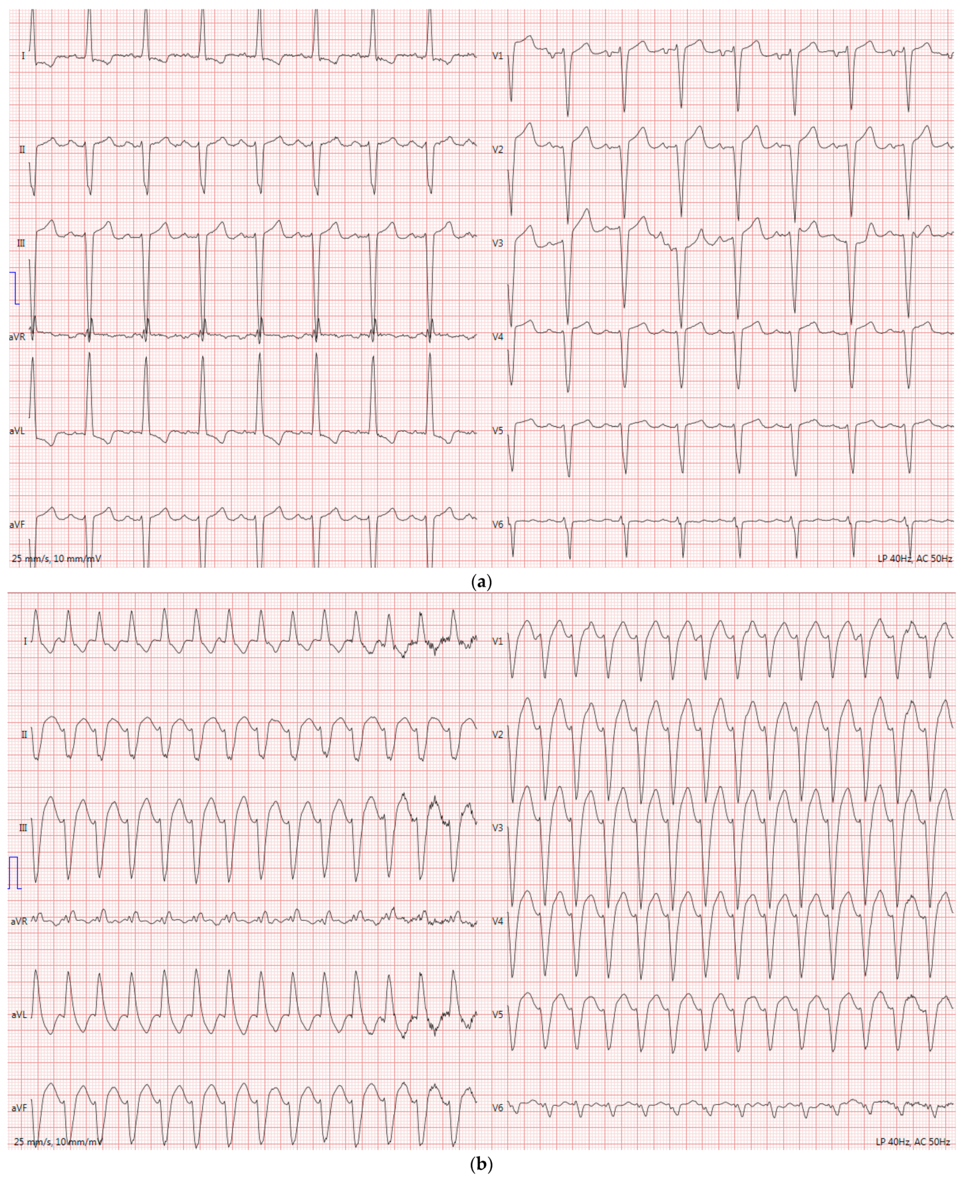 Hearts 02 00044 g001