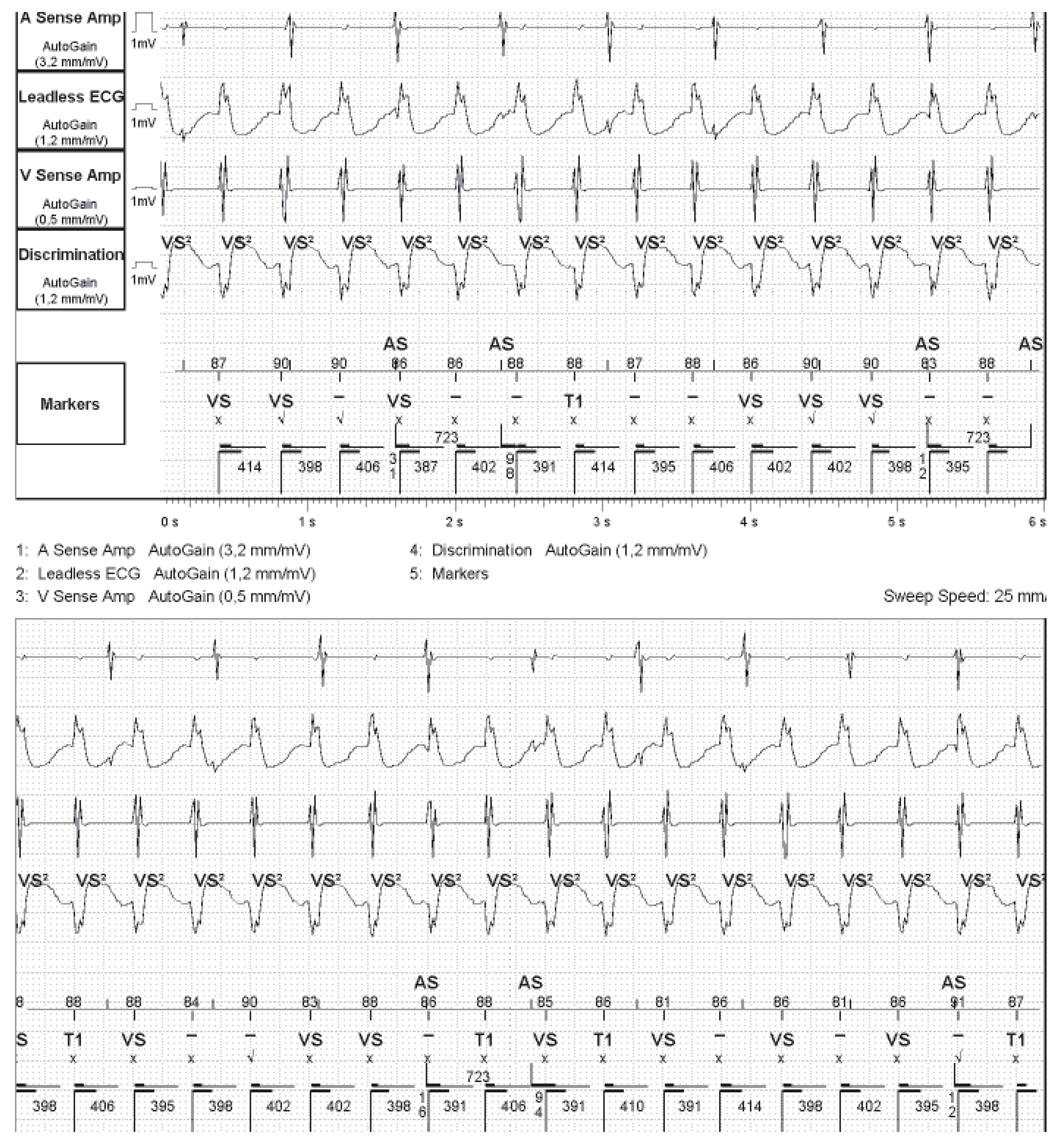 Hearts 02 00044 g002
