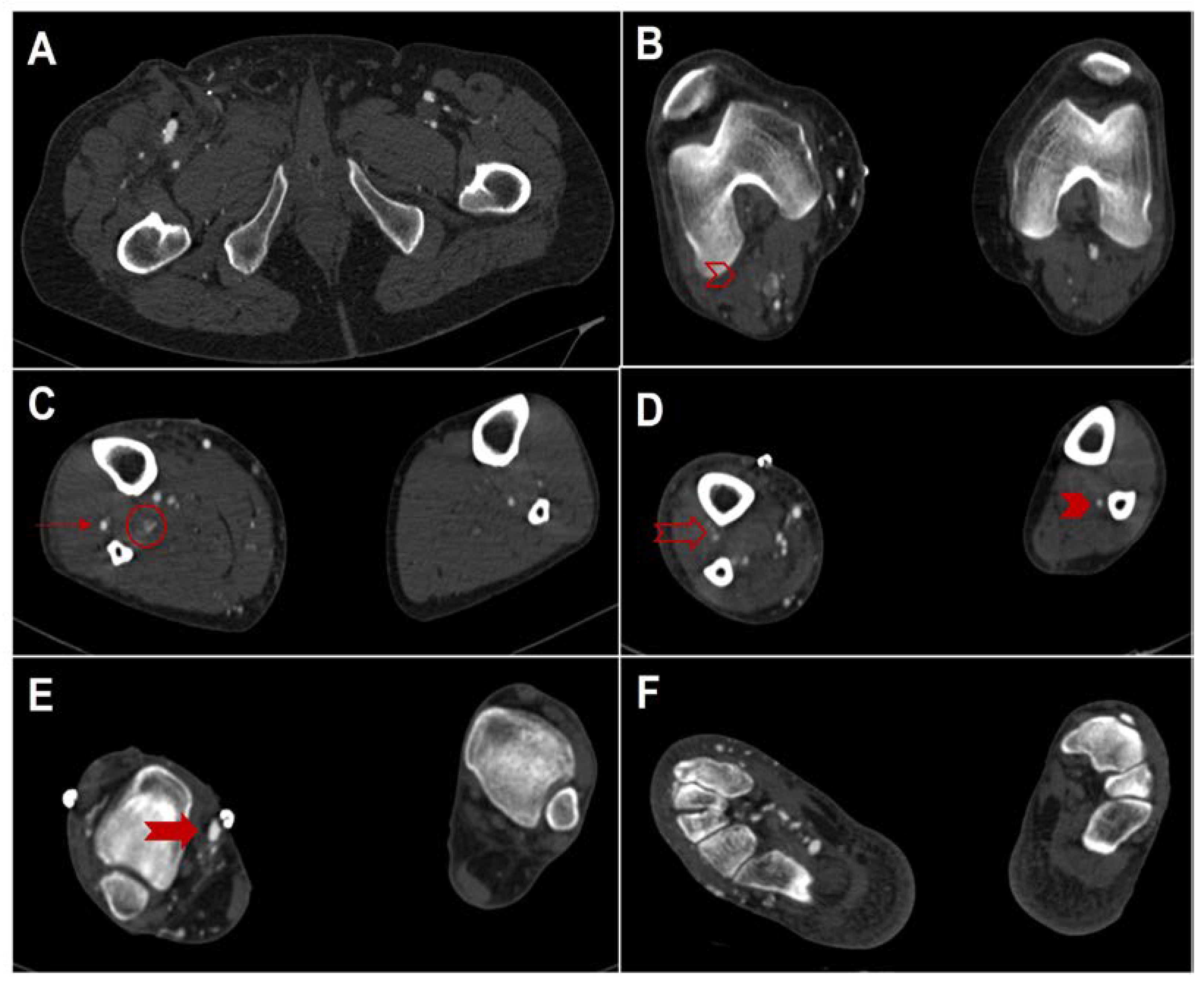 Hearts 04 00002 g002