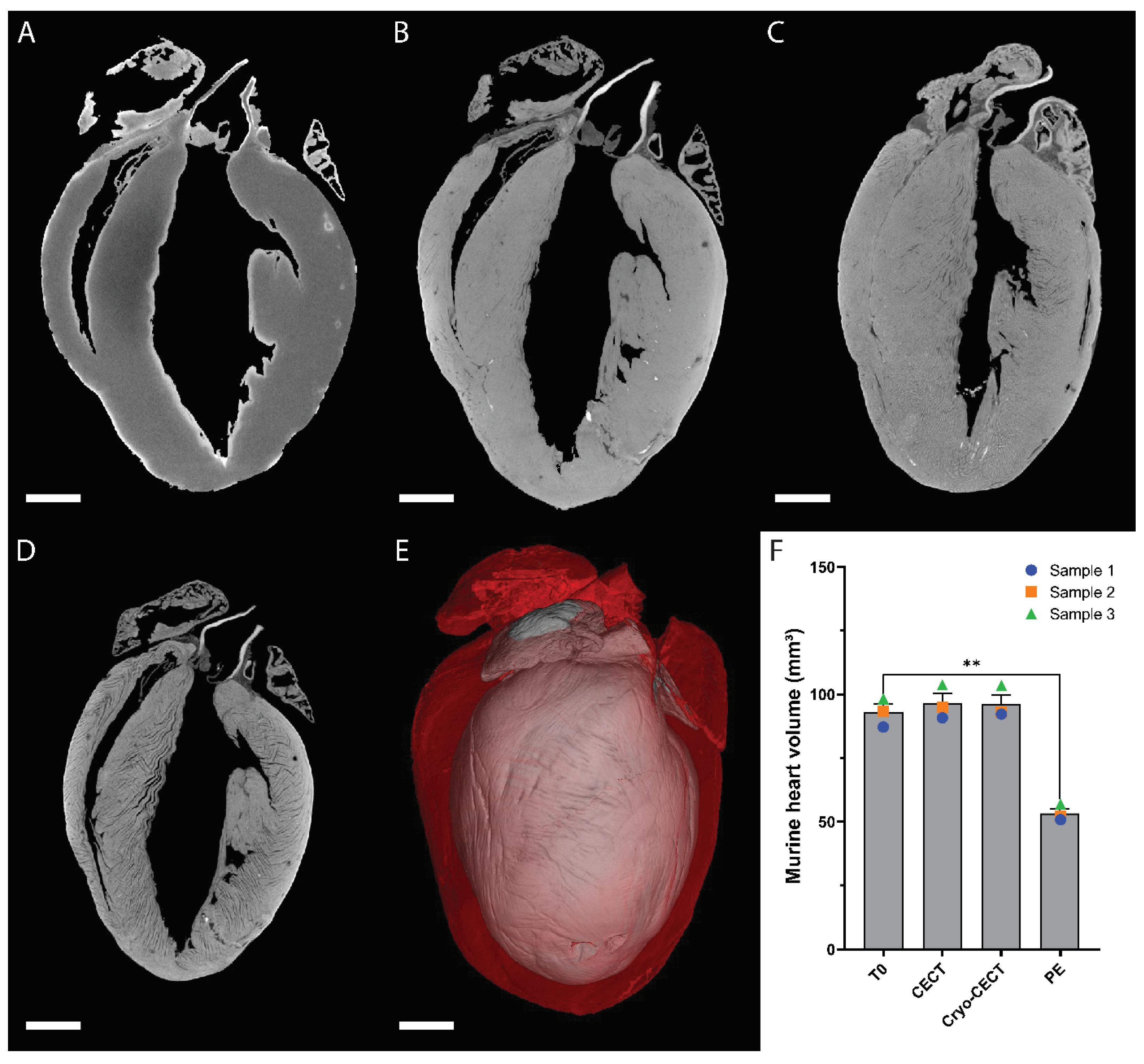 Hearts 05 00002 g001