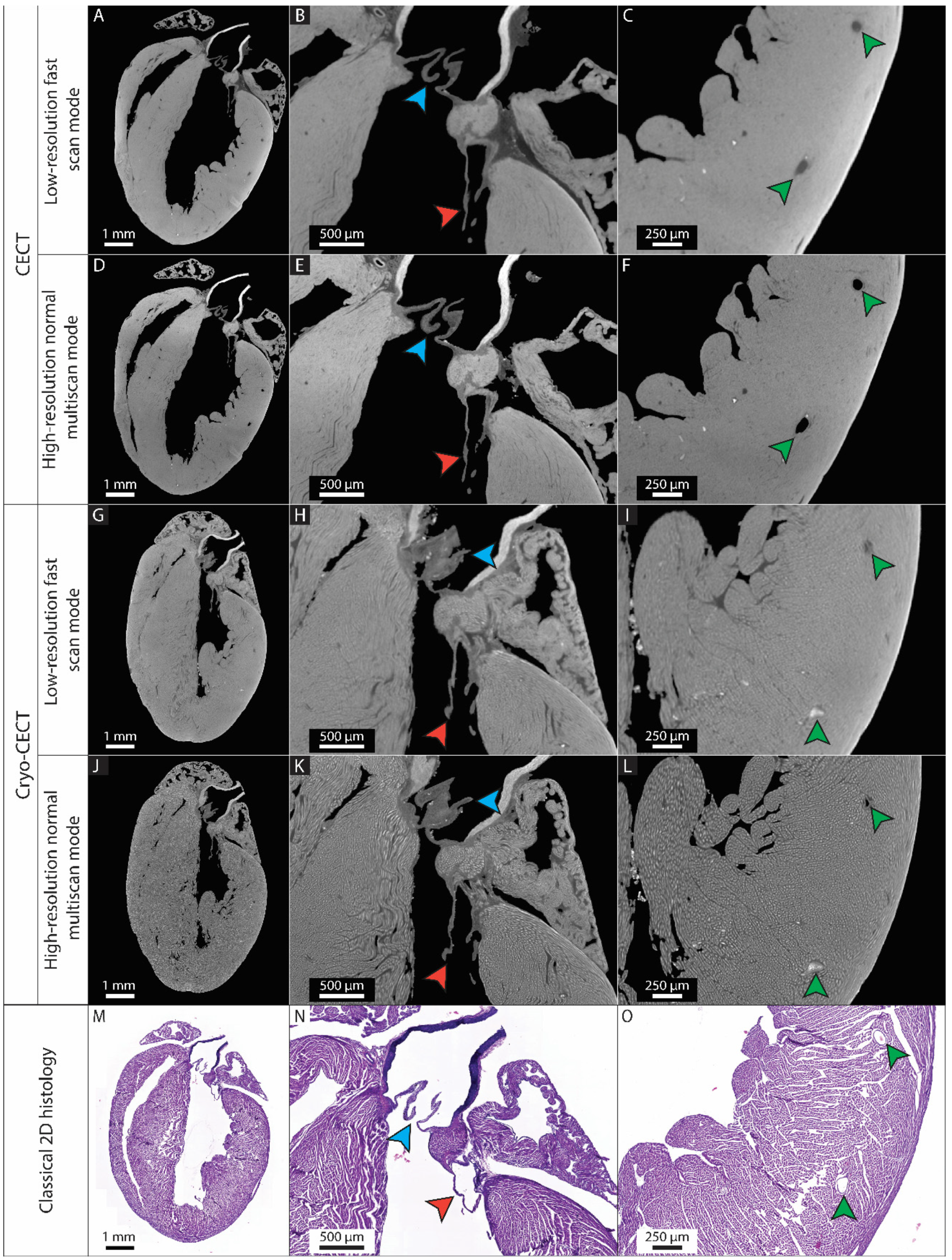 Hearts 05 00002 g002