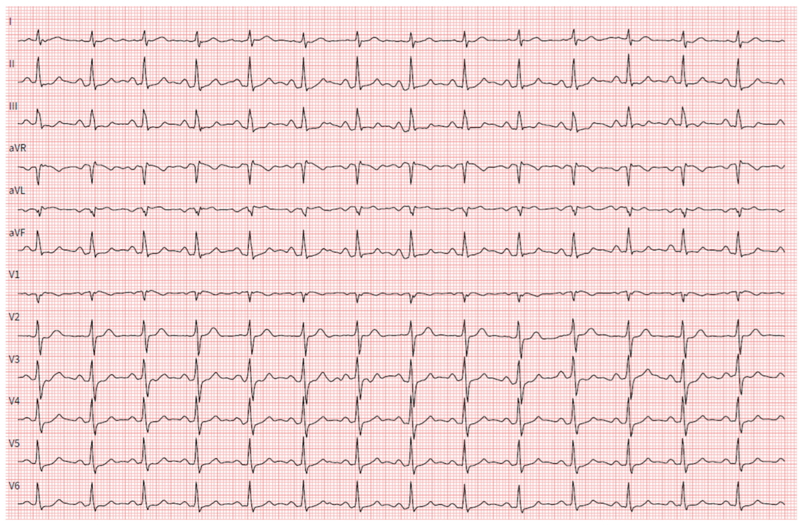 Hearts 05 00034 g001 Hearts 05 00034 g001