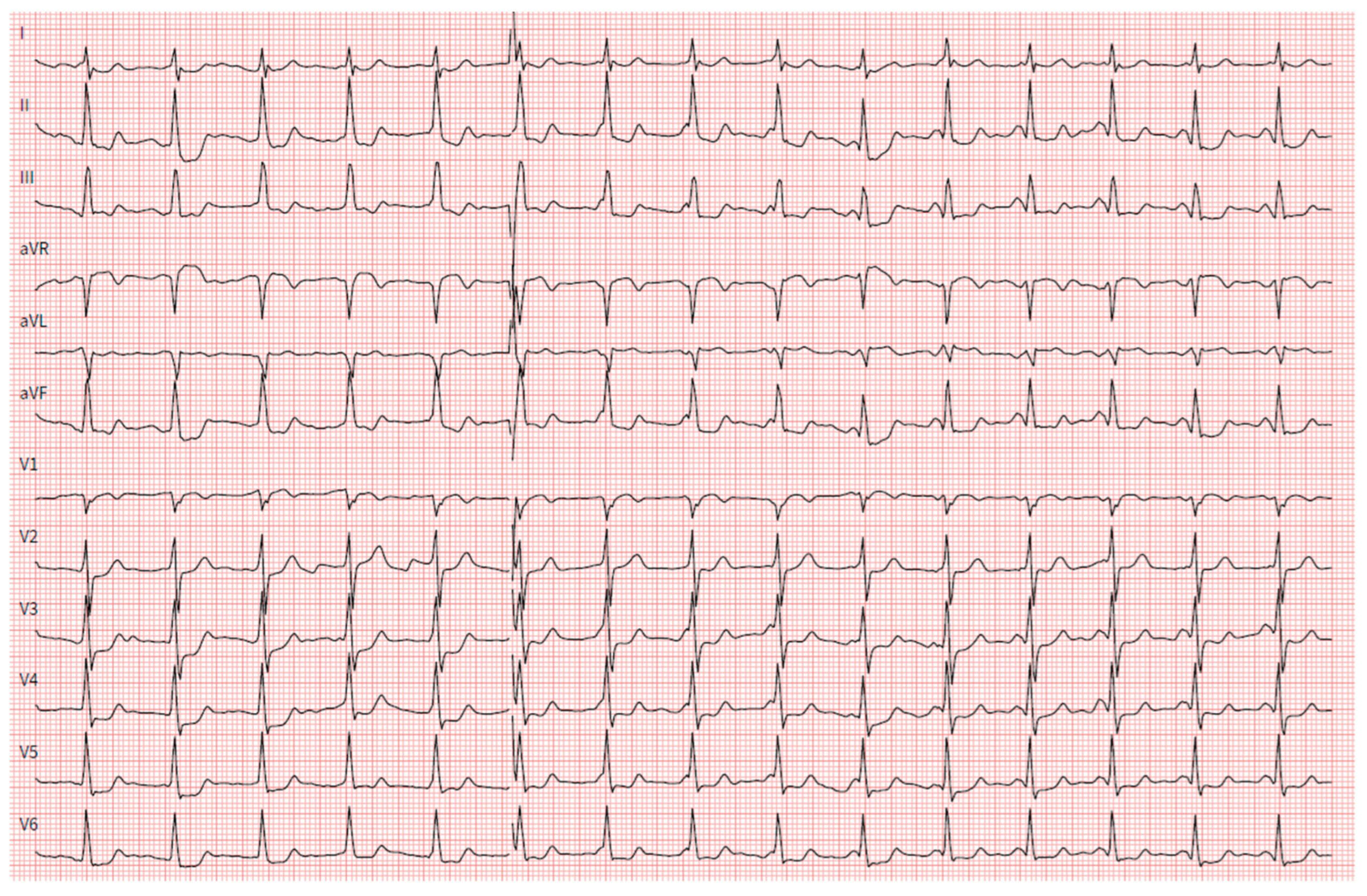 Hearts 05 00034 g003 Hearts 05 00034 g003