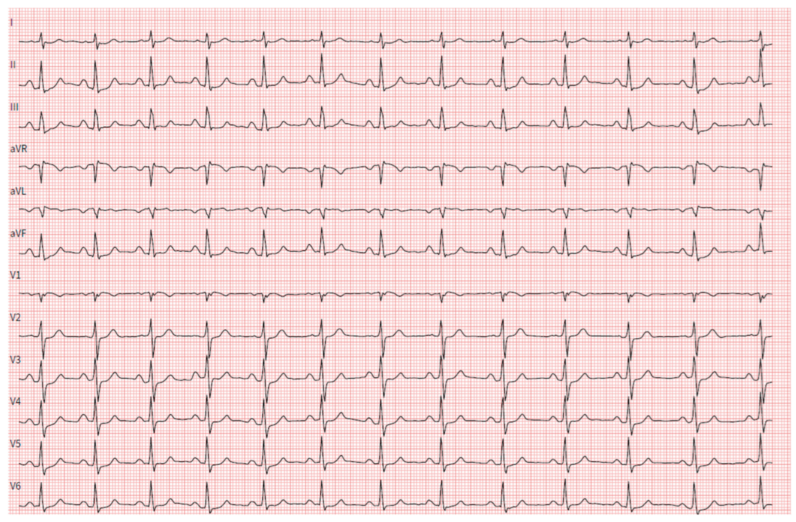 Hearts 05 00034 g004 Hearts 05 00034 g004