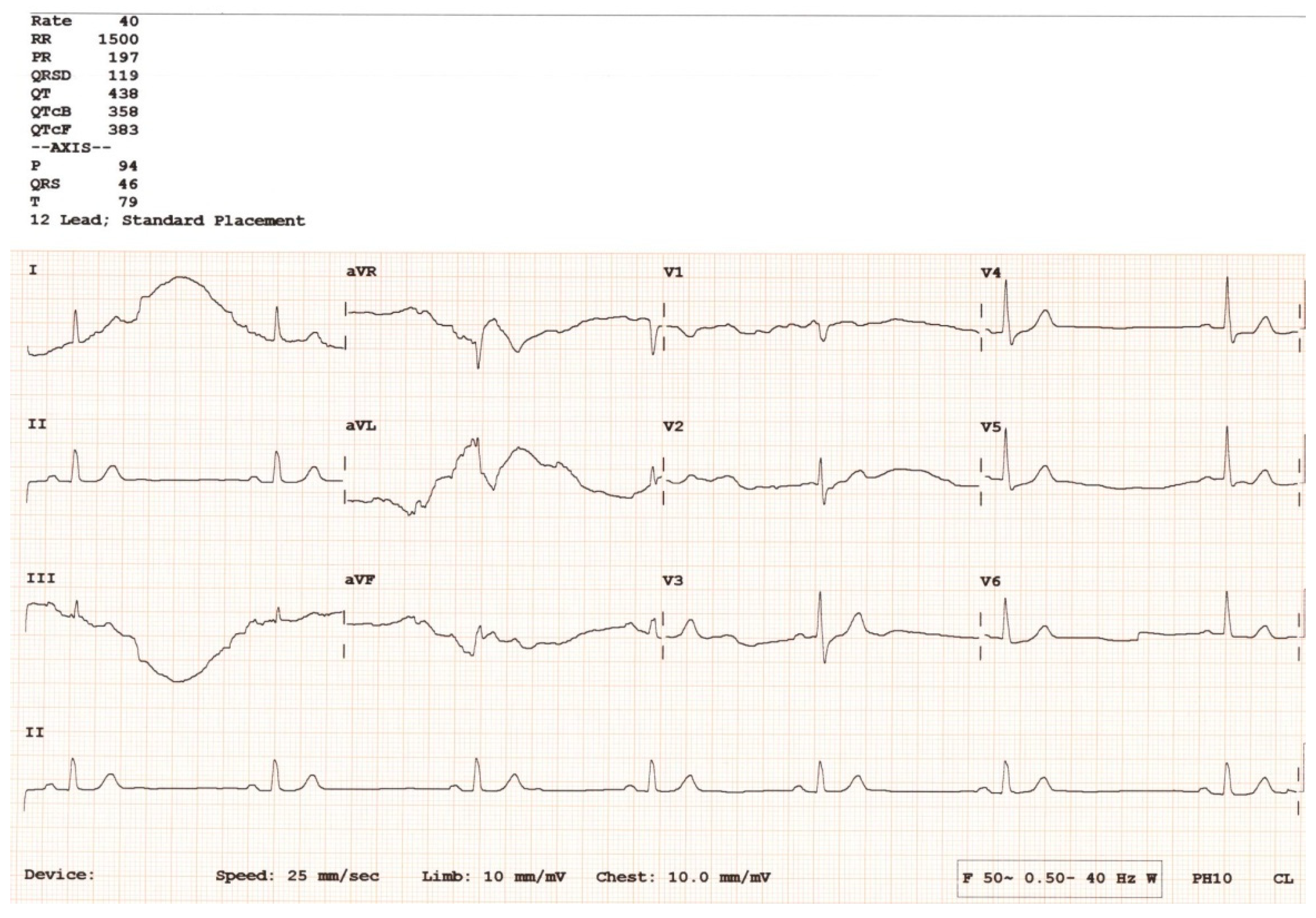 Hearts 05 00034 g005 Hearts 05 00034 g005