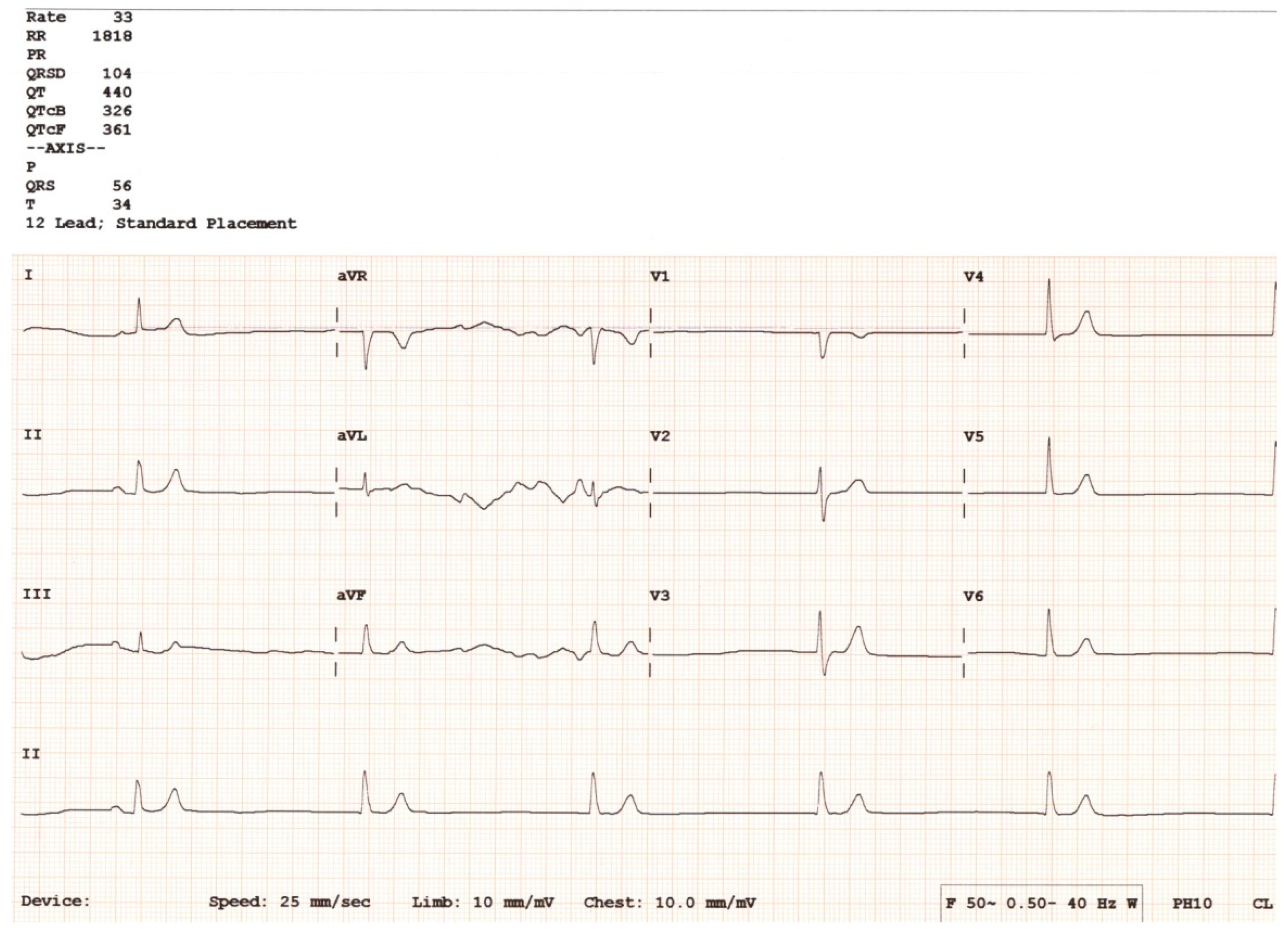 Hearts 05 00034 g006 Hearts 05 00034 g006