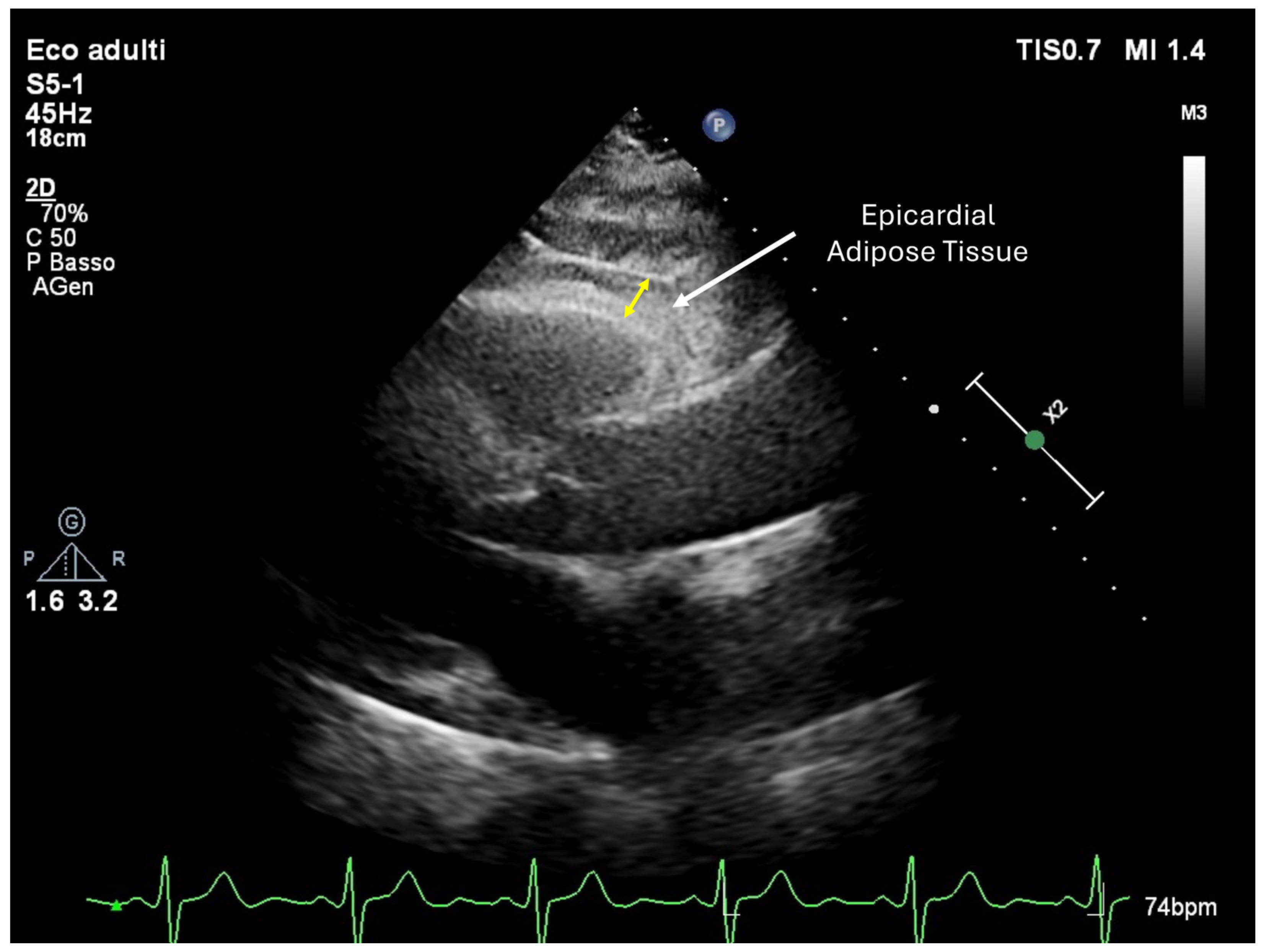 Hearts 06 00003 g002