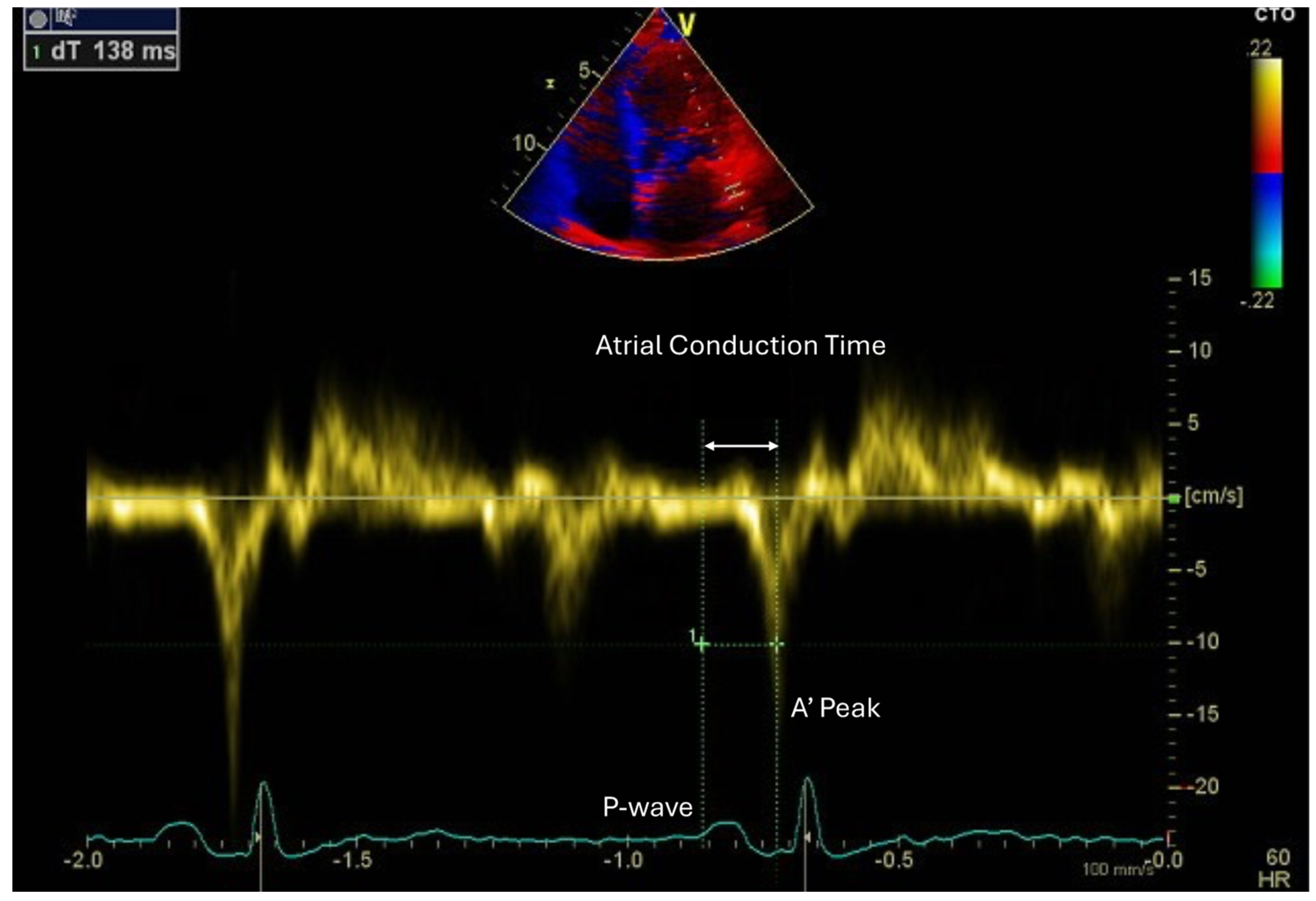 Hearts 06 00003 g004