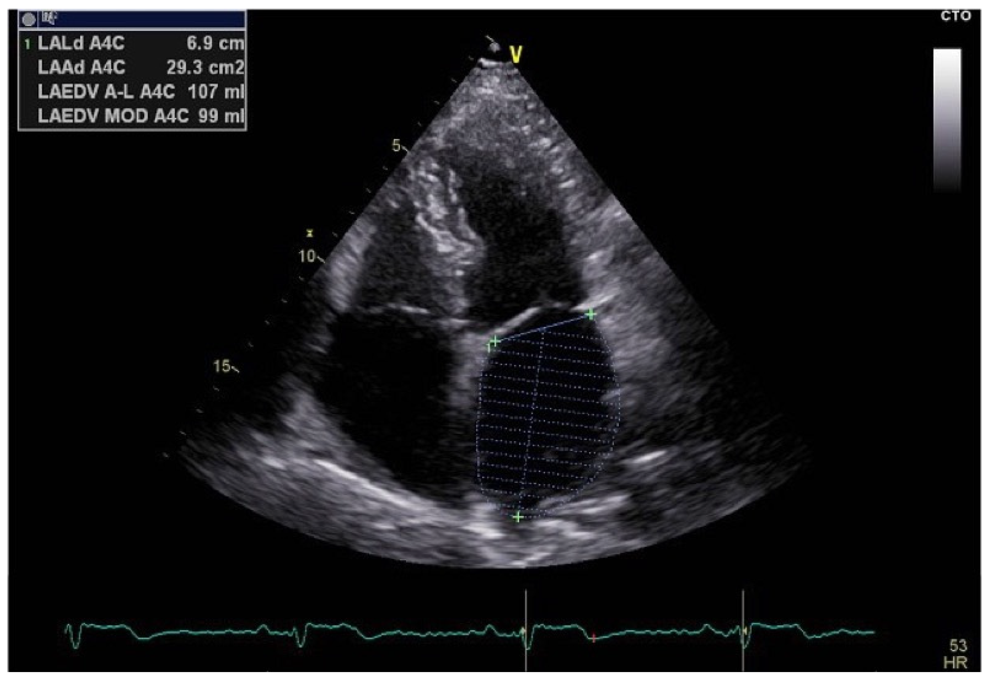 Hearts 06 00003 g005