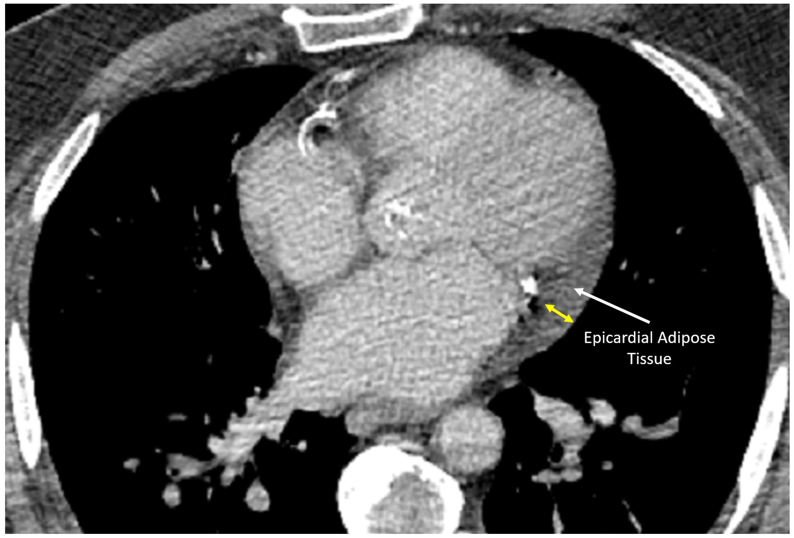 Hearts 06 00003 g008