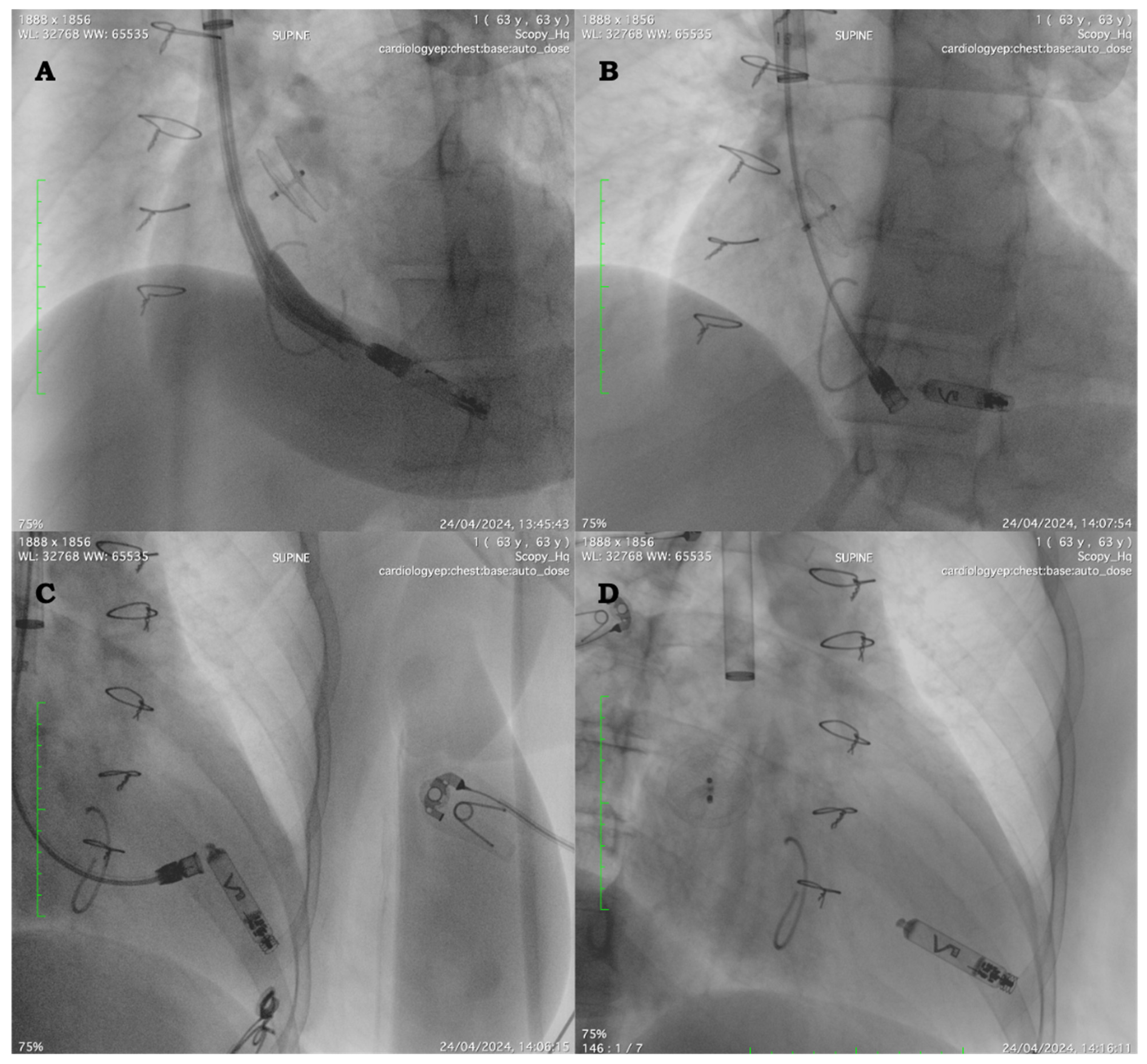 Hearts 06 00010 g001