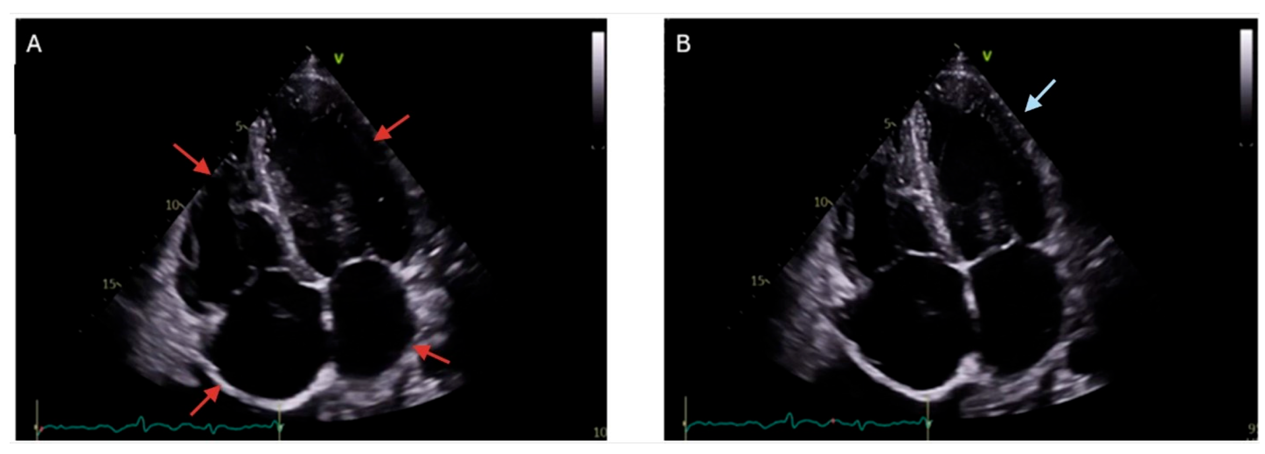 Hearts 06 00017 g003