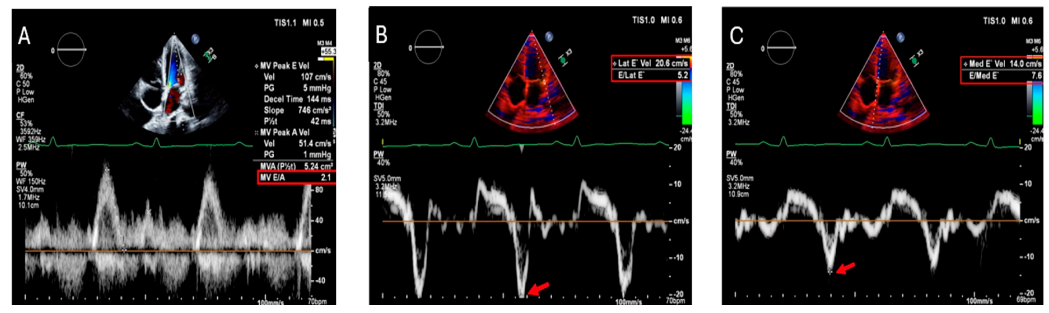 Hearts 06 00017 g004
