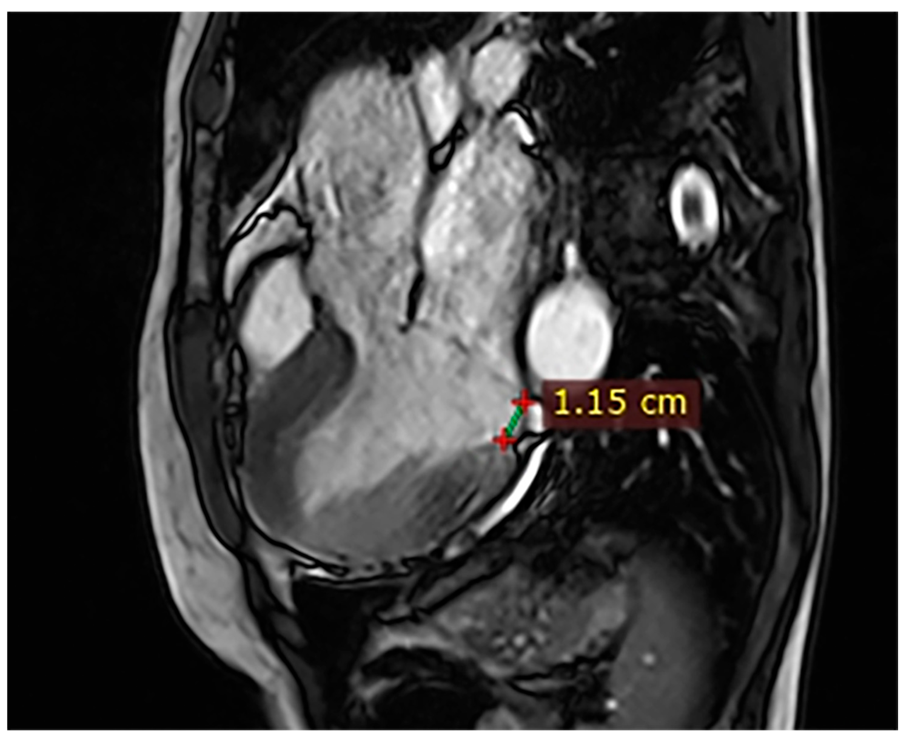 Hearts 07 00002 g002 Hearts 07 00002 g002
