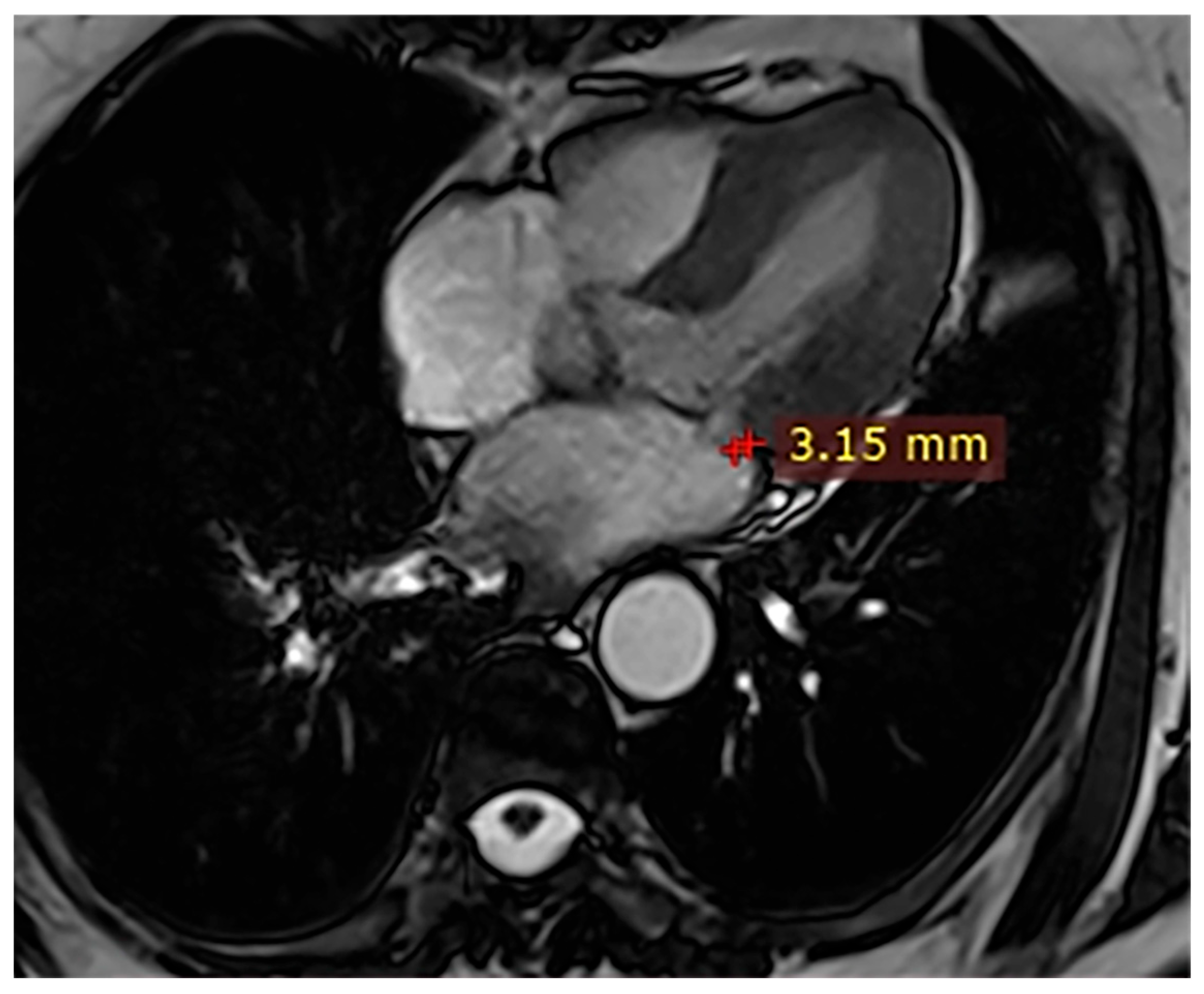 Hearts 07 00002 g003 Hearts 07 00002 g003