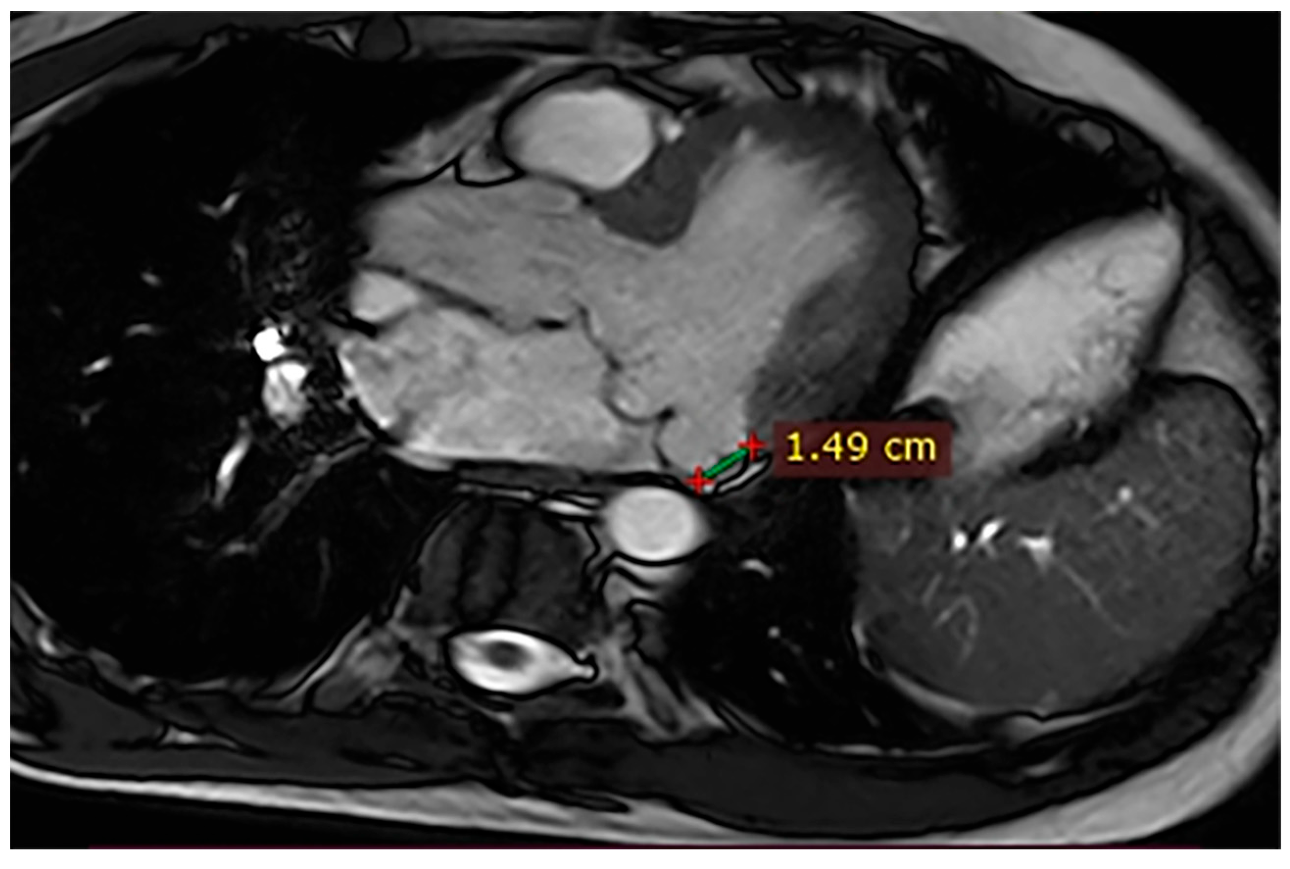 Hearts 07 00002 g004 Hearts 07 00002 g004