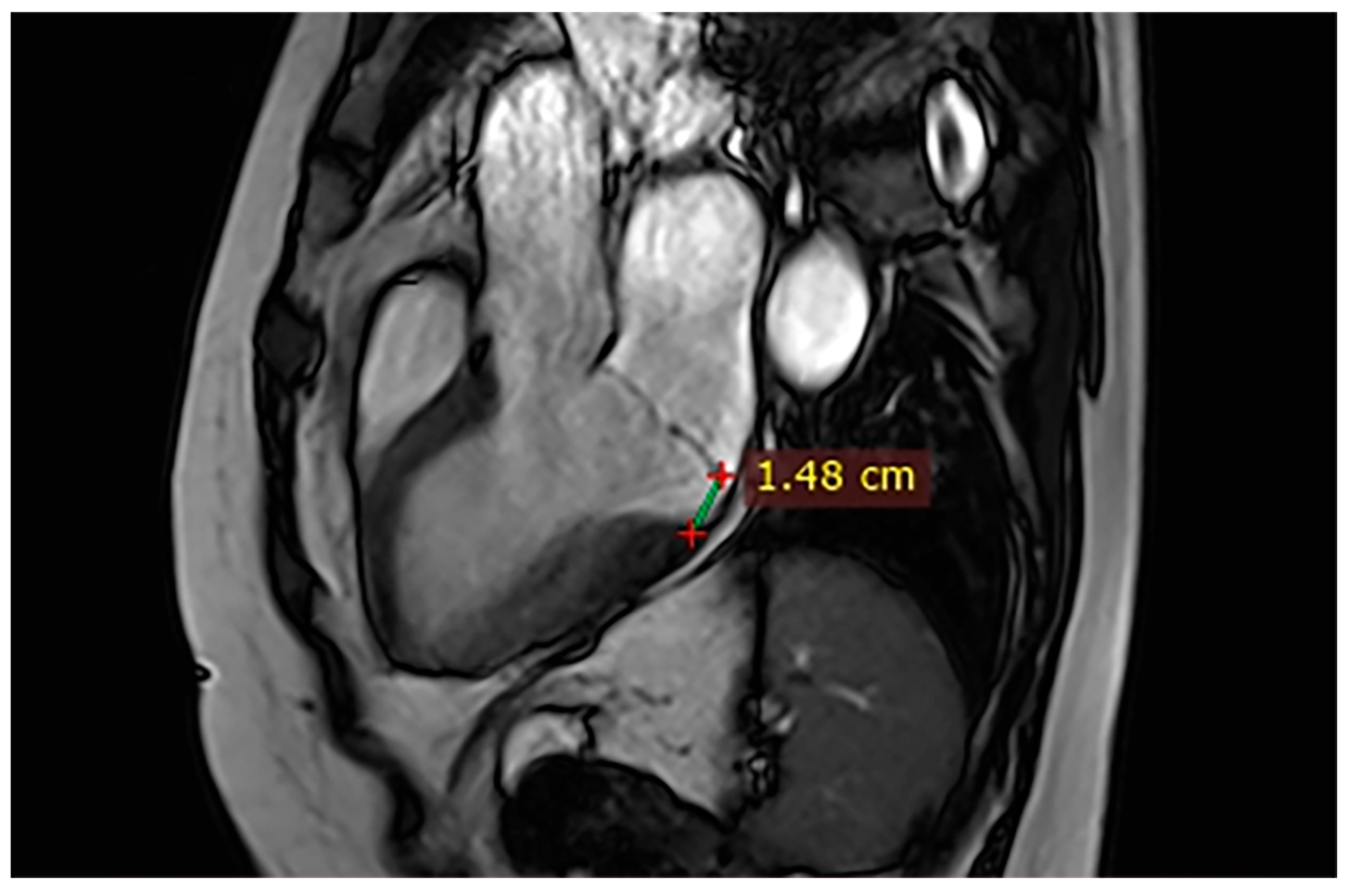 Hearts 07 00002 g006 Hearts 07 00002 g006