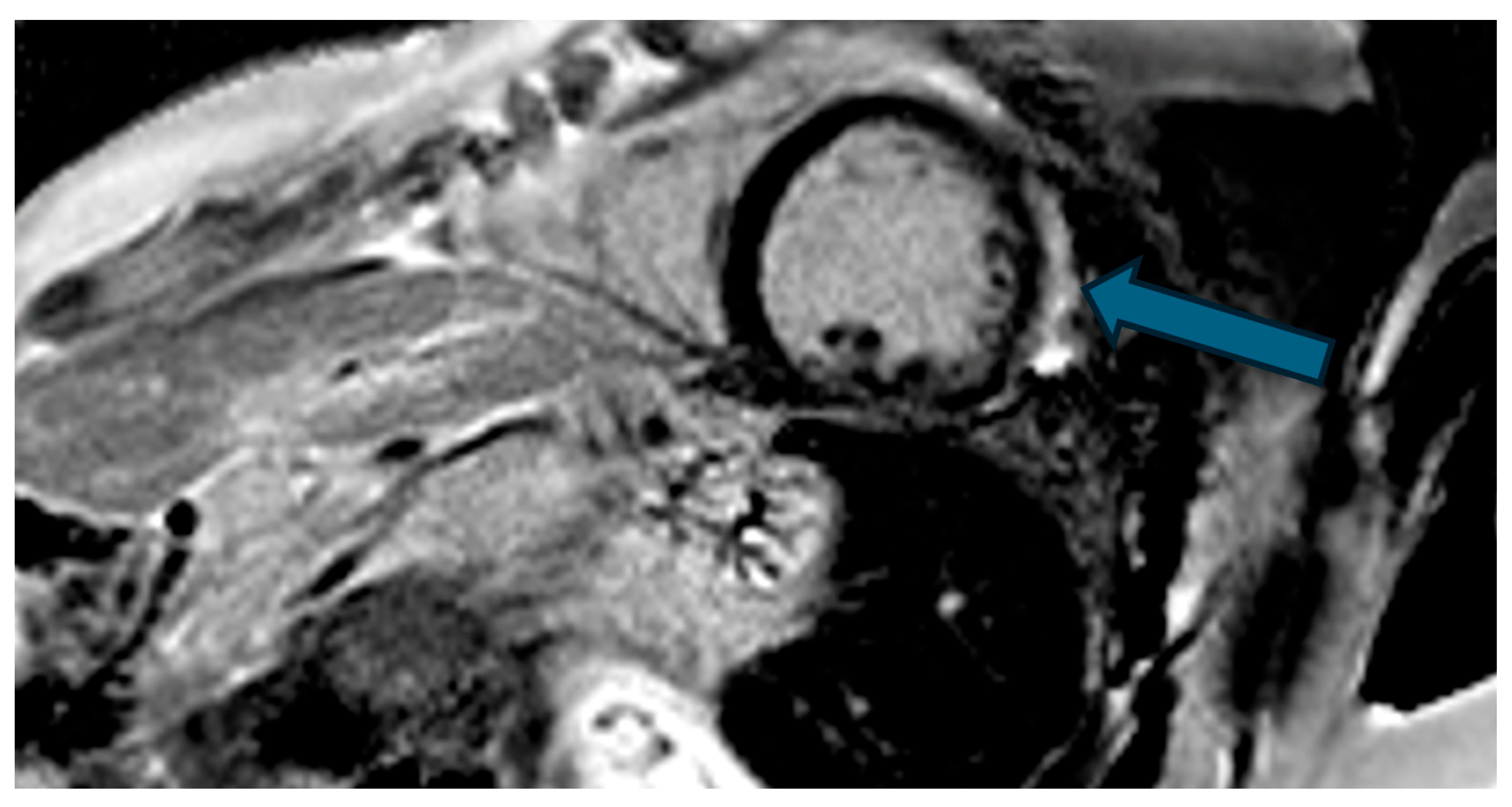 Hearts 07 00002 g007 Hearts 07 00002 g007