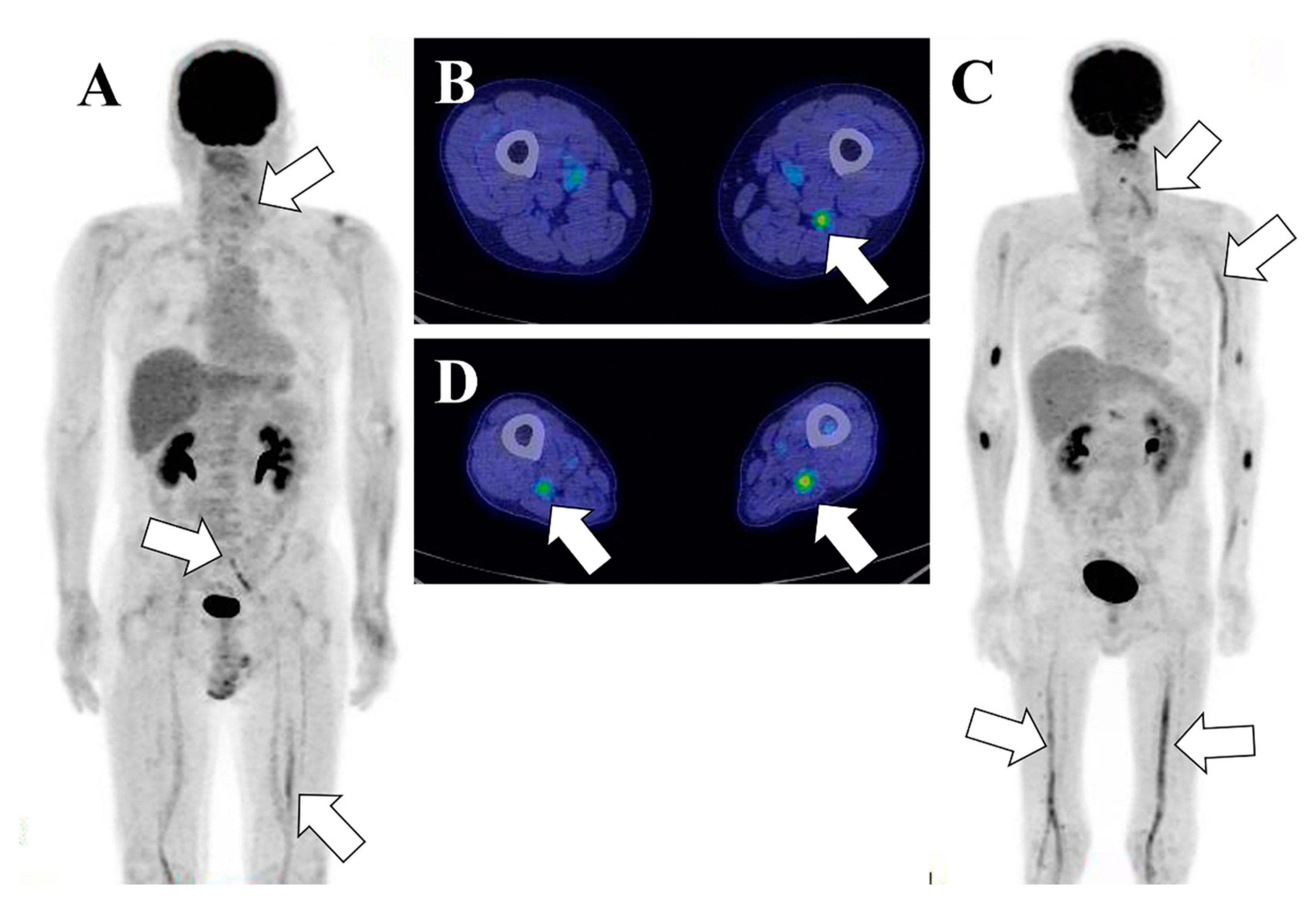 Hemato 02 00038 g004