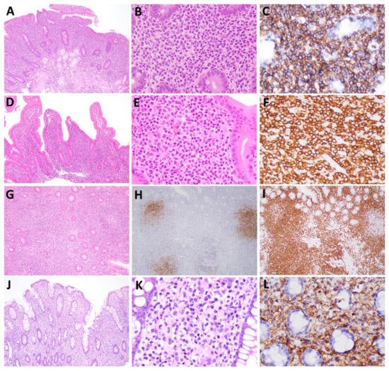 Hemato 03 00018 g001