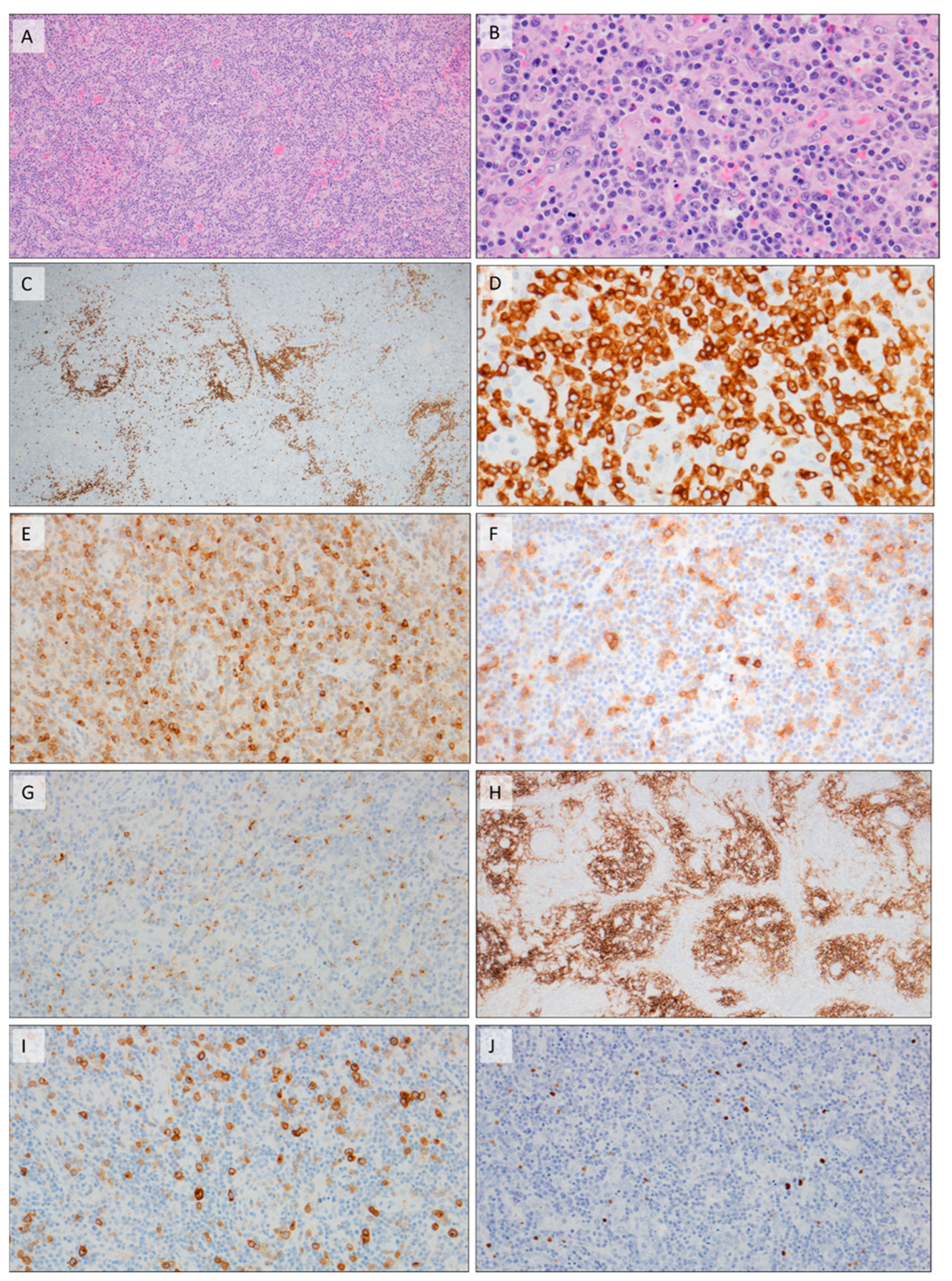 Hemato 03 00020 g003