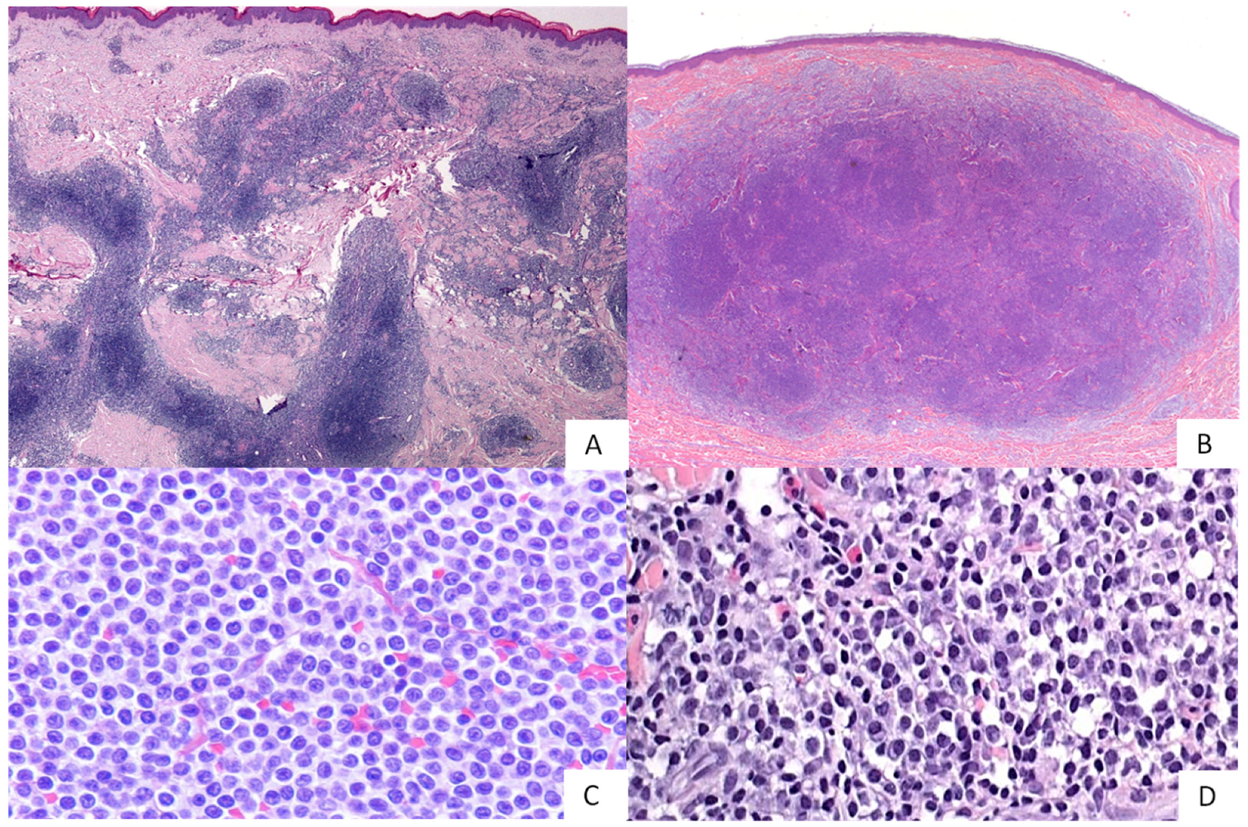Hemato 03 00023 g001 Hemato 03 00023 g001