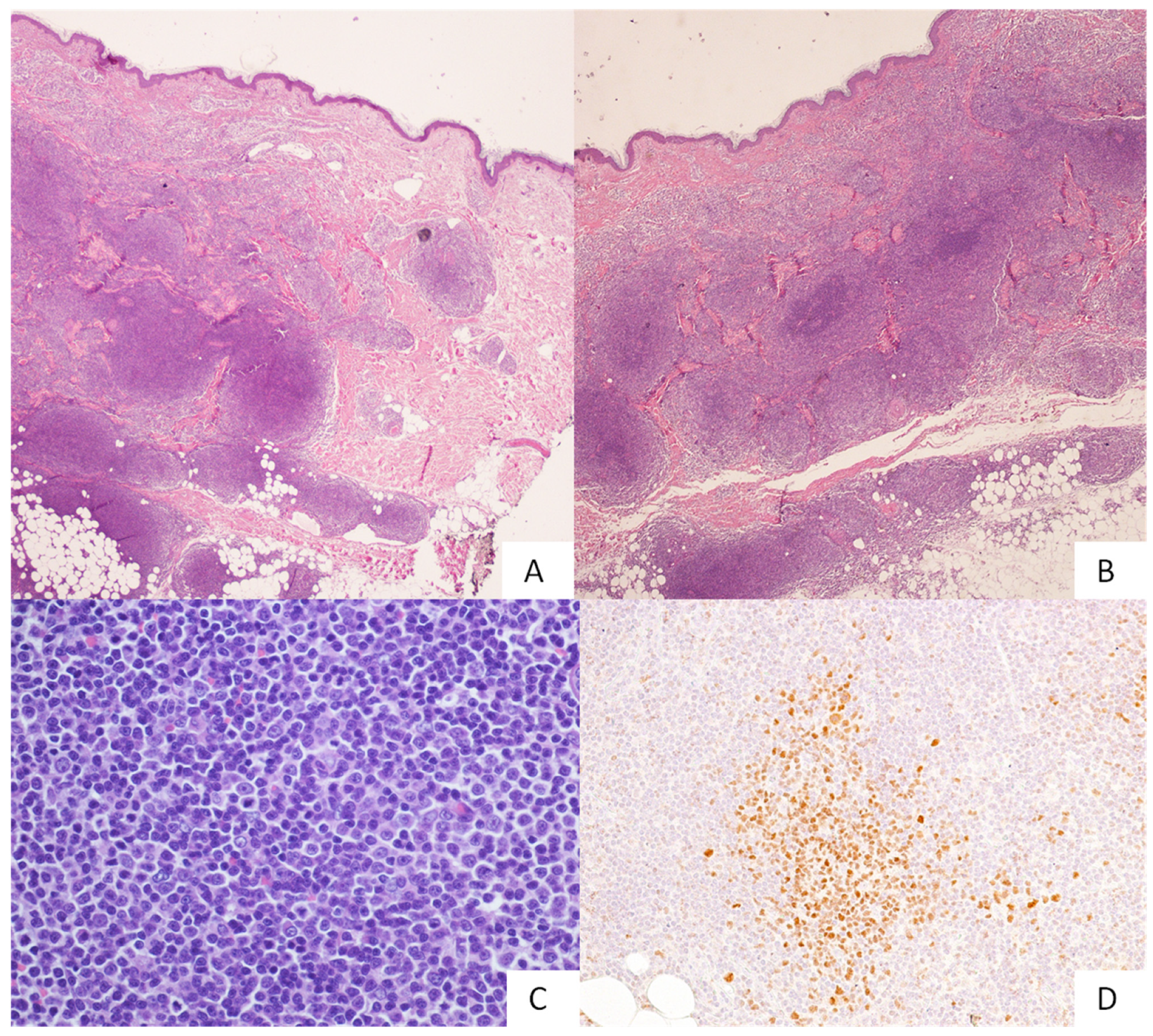 Hemato 03 00023 g002 Hemato 03 00023 g002