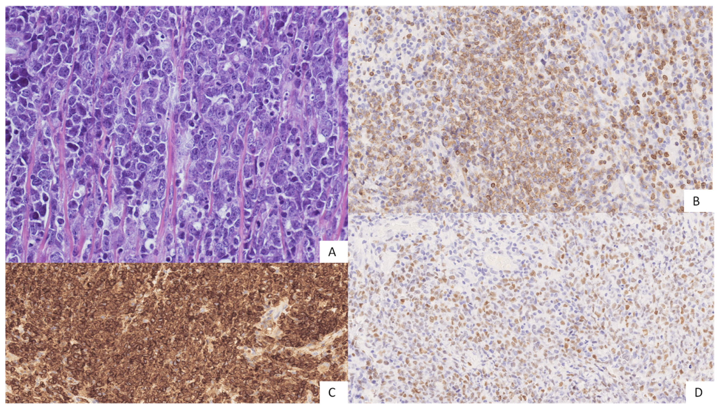 Hemato 03 00023 g003 Hemato 03 00023 g003