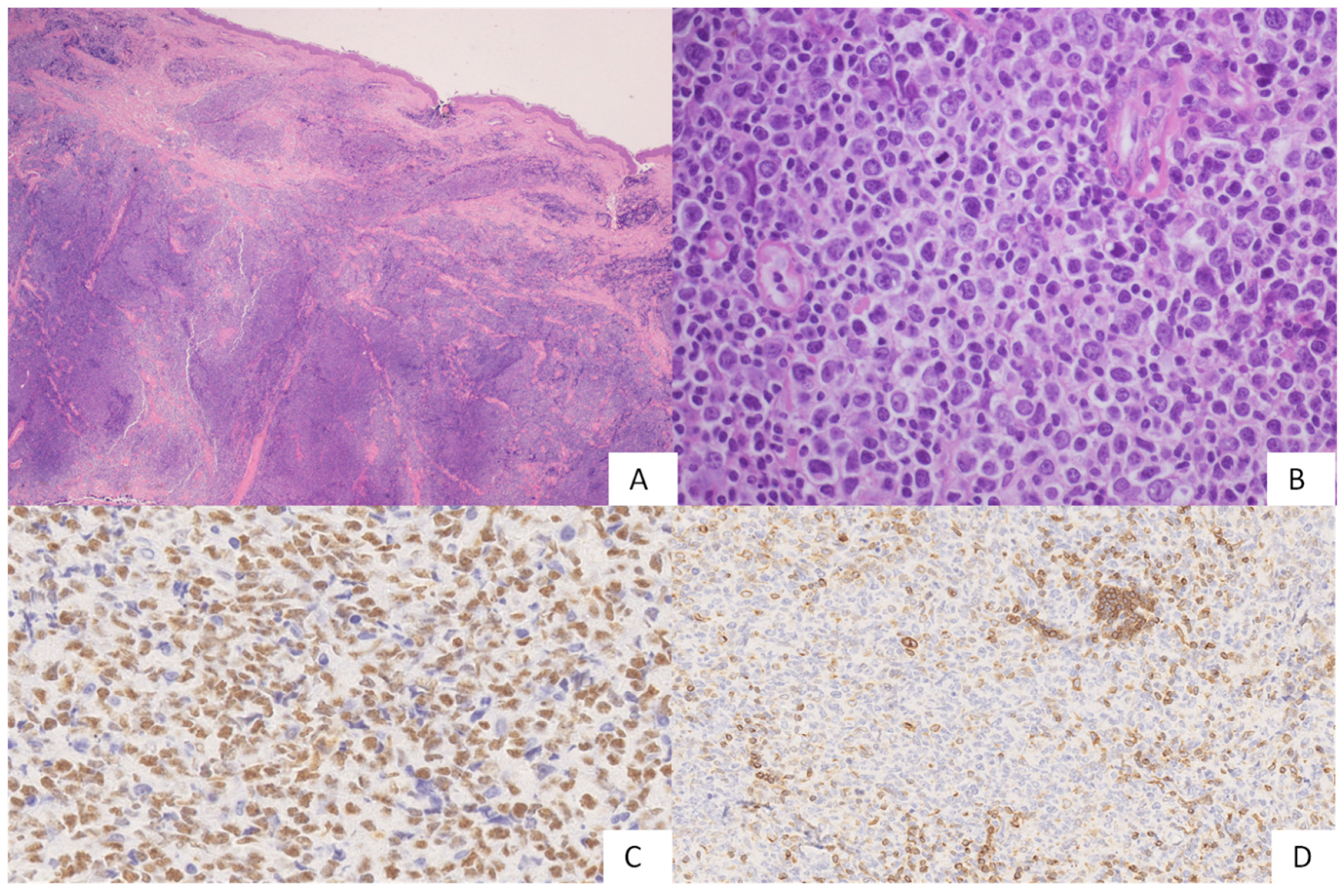 Hemato 03 00023 g004 Hemato 03 00023 g004