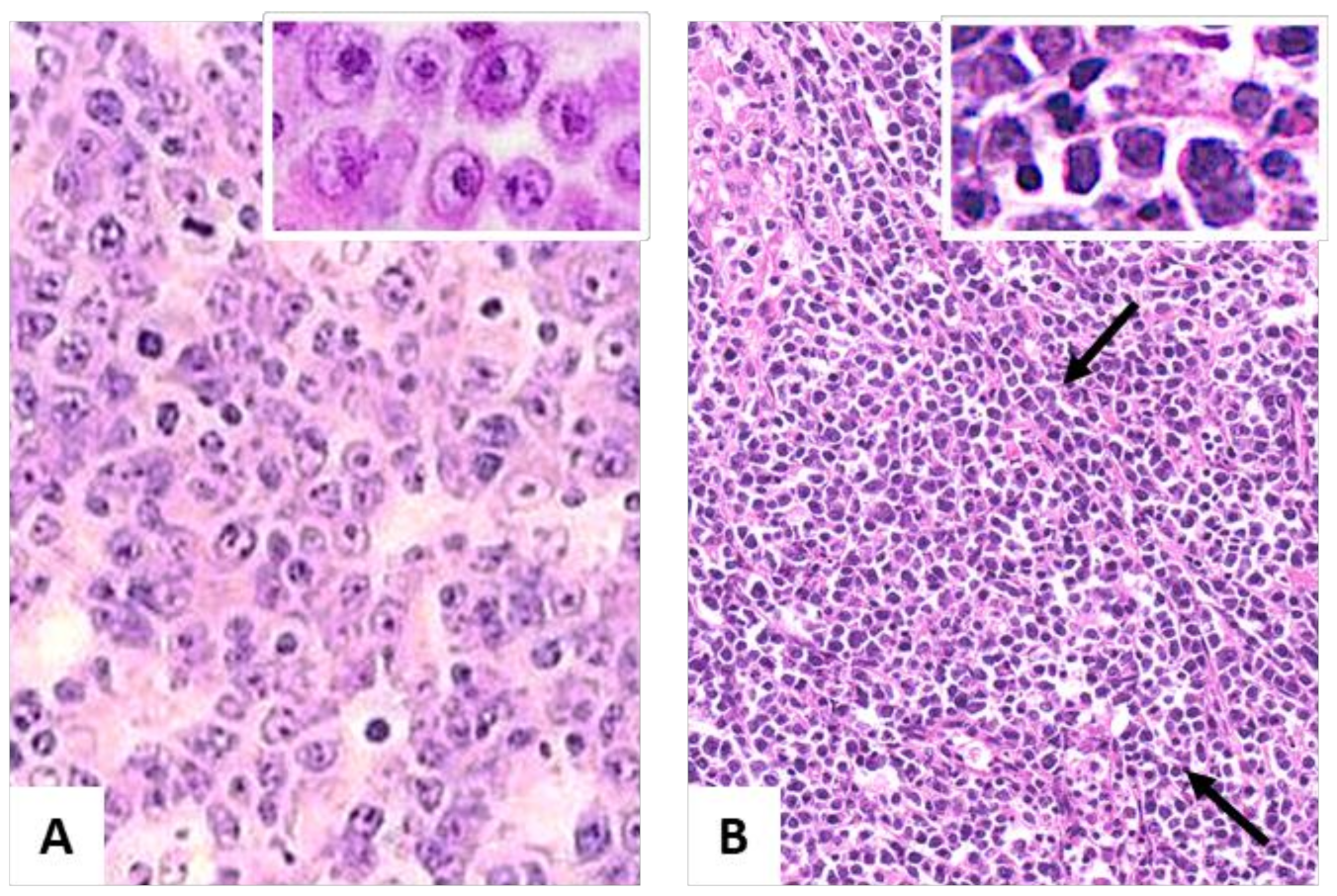 Hemato 03 00037 g001