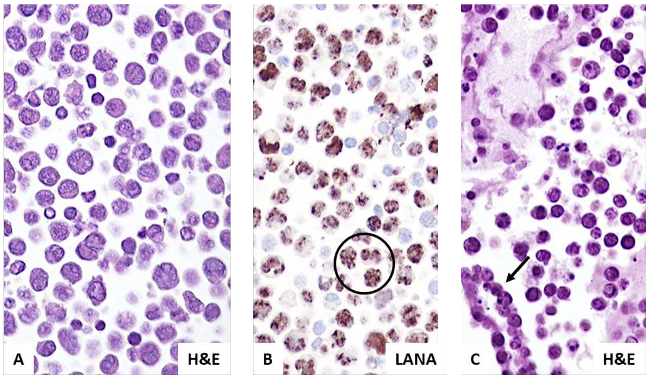Hemato 03 00037 g002