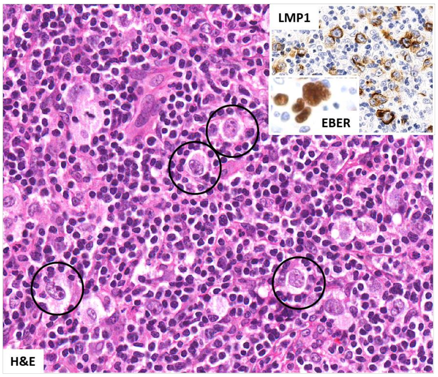 Hemato 03 00037 g003