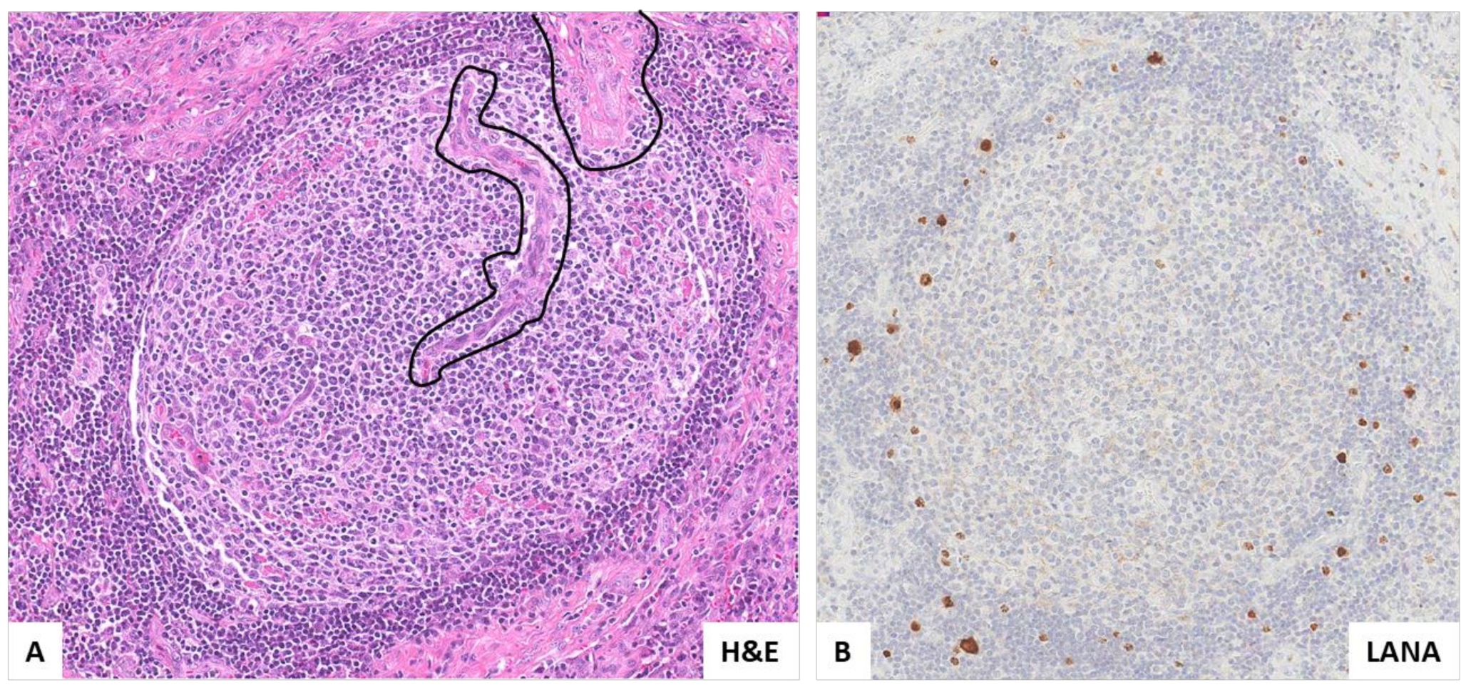 Hemato 03 00037 g004