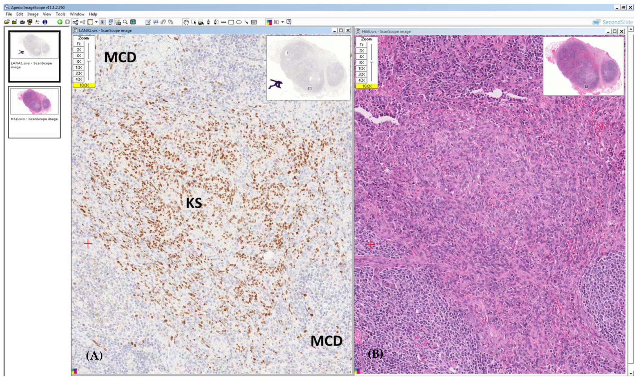 Hemato 03 00037 g005