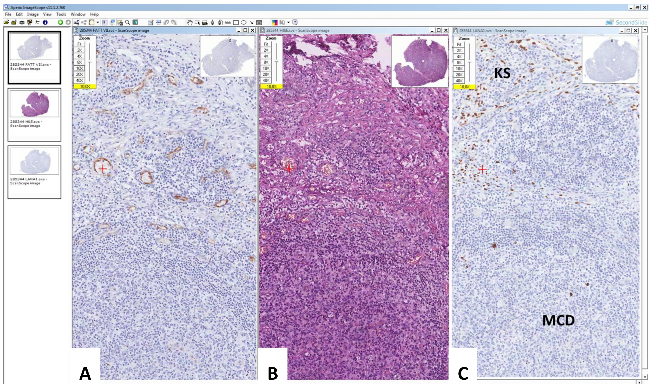 Hemato 03 00037 g006