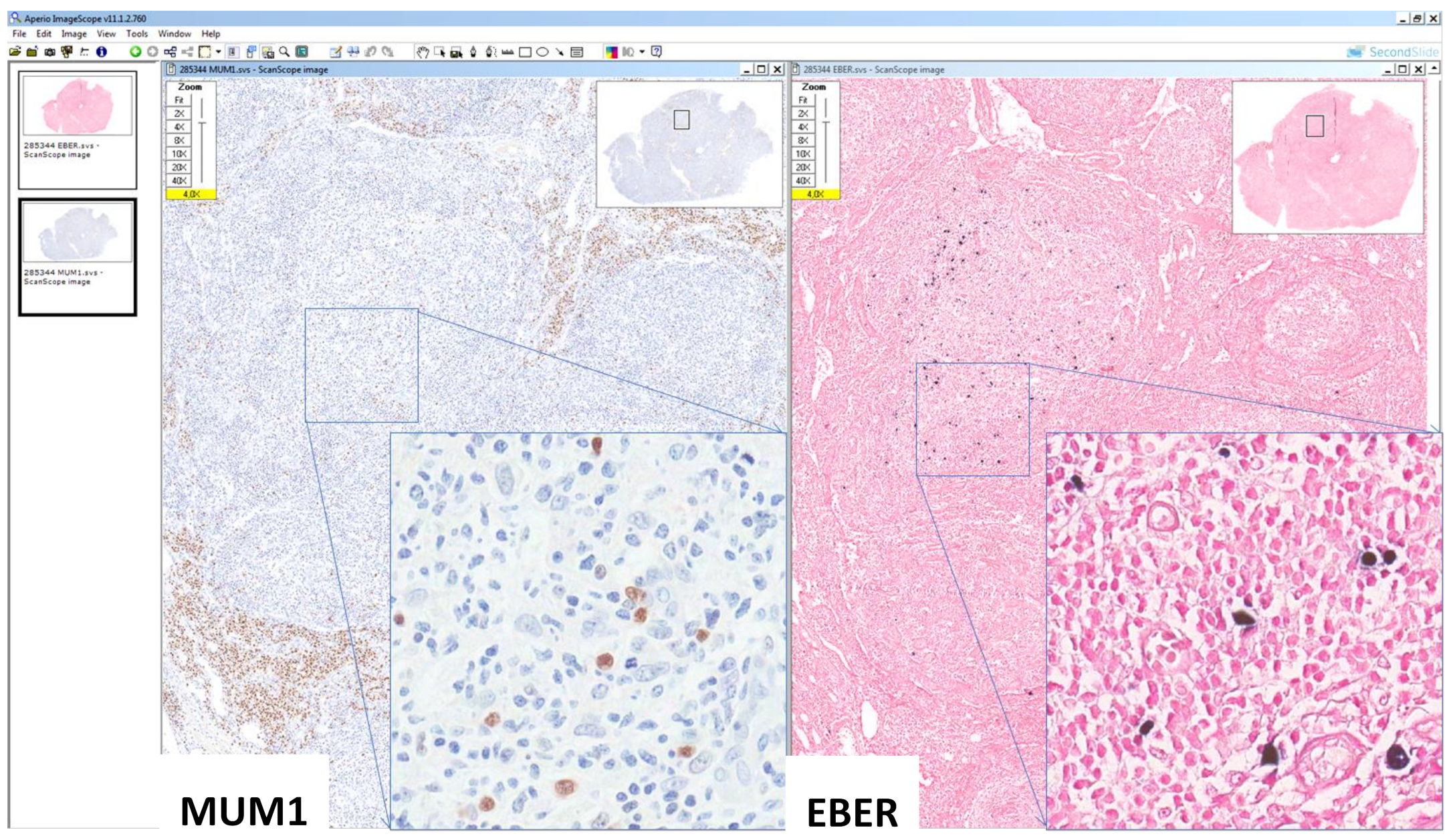 Hemato 03 00037 g007