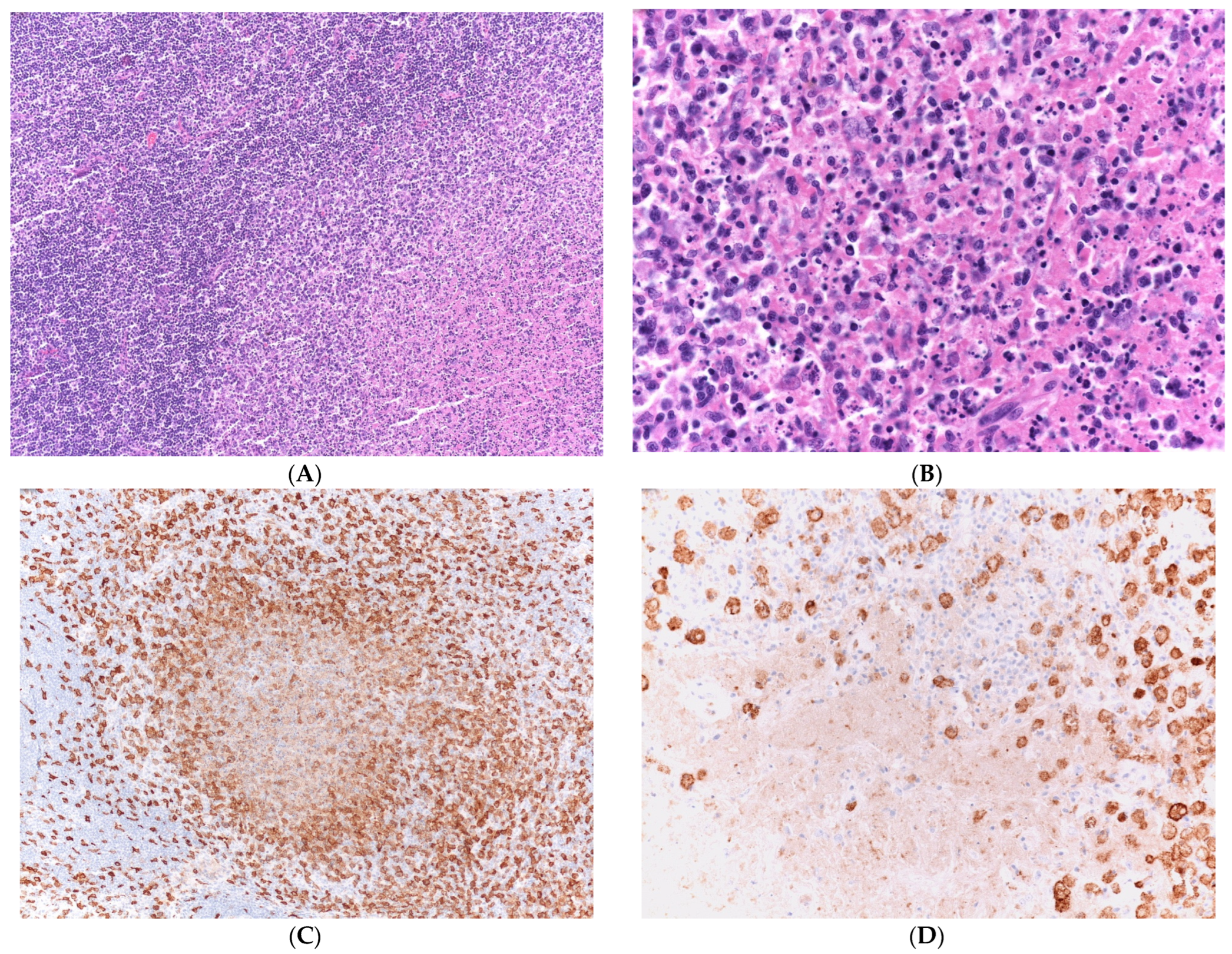 Hemato 04 00022 g003