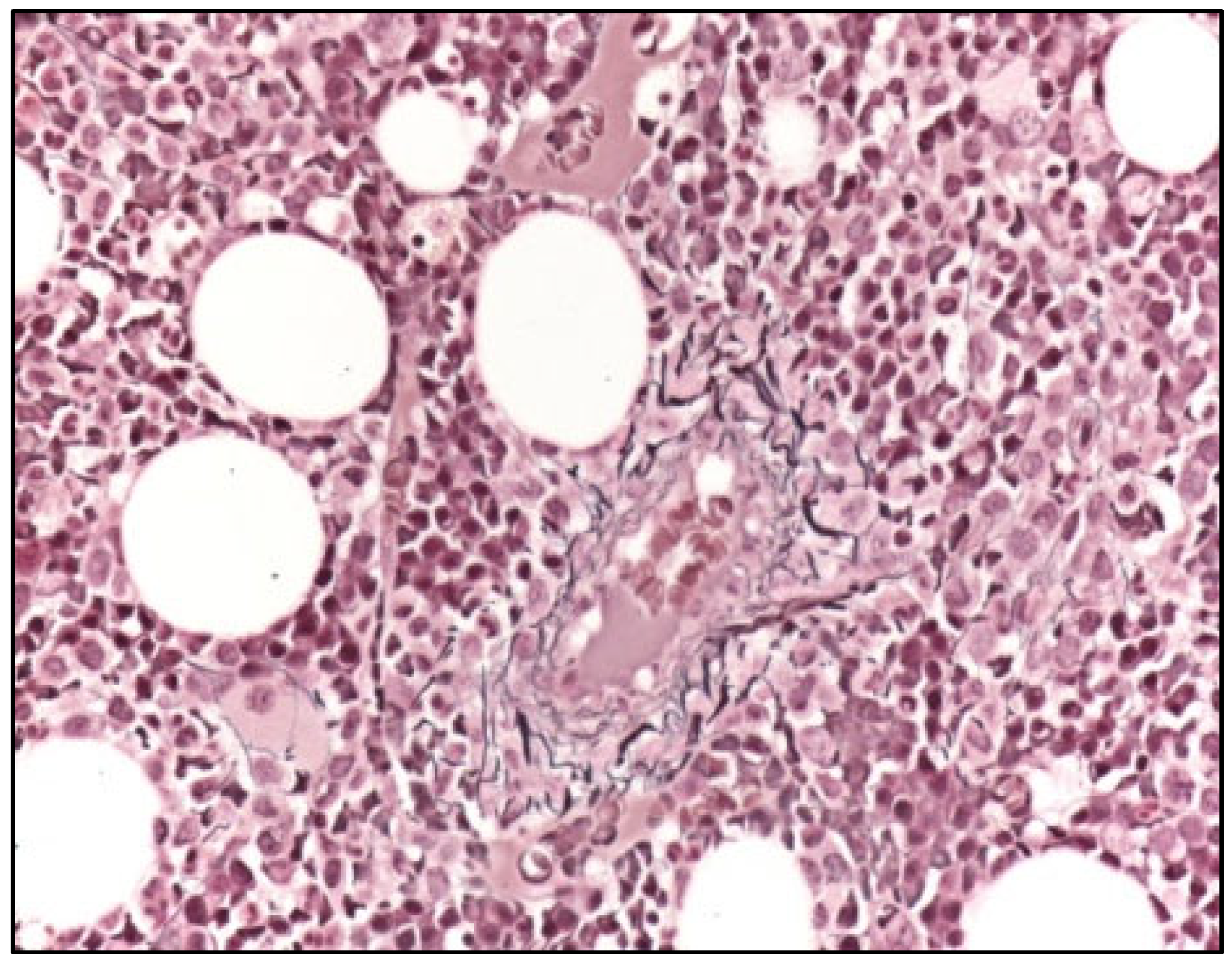 Hemato 05 00021 g003