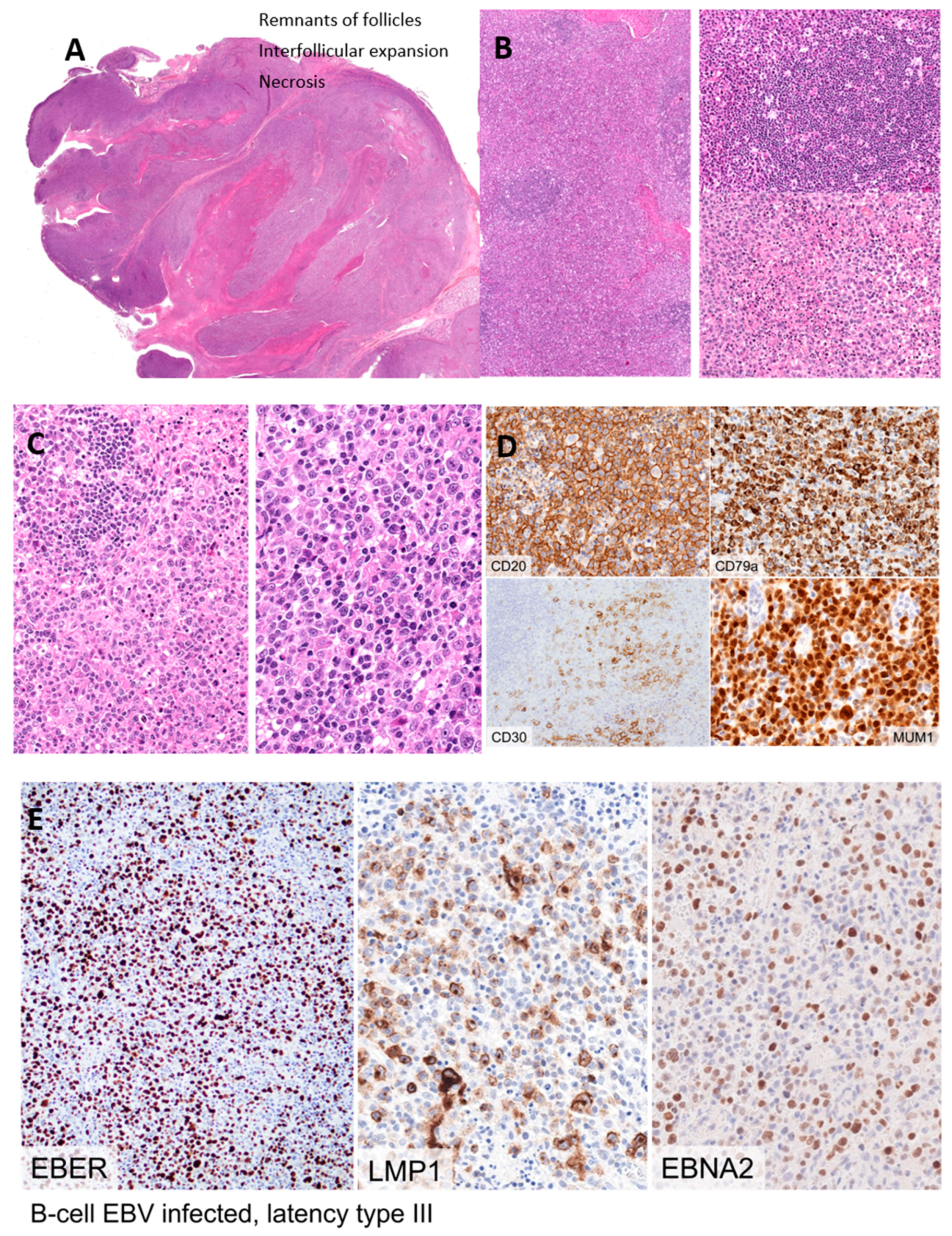 Hemato 05 00026 g003a