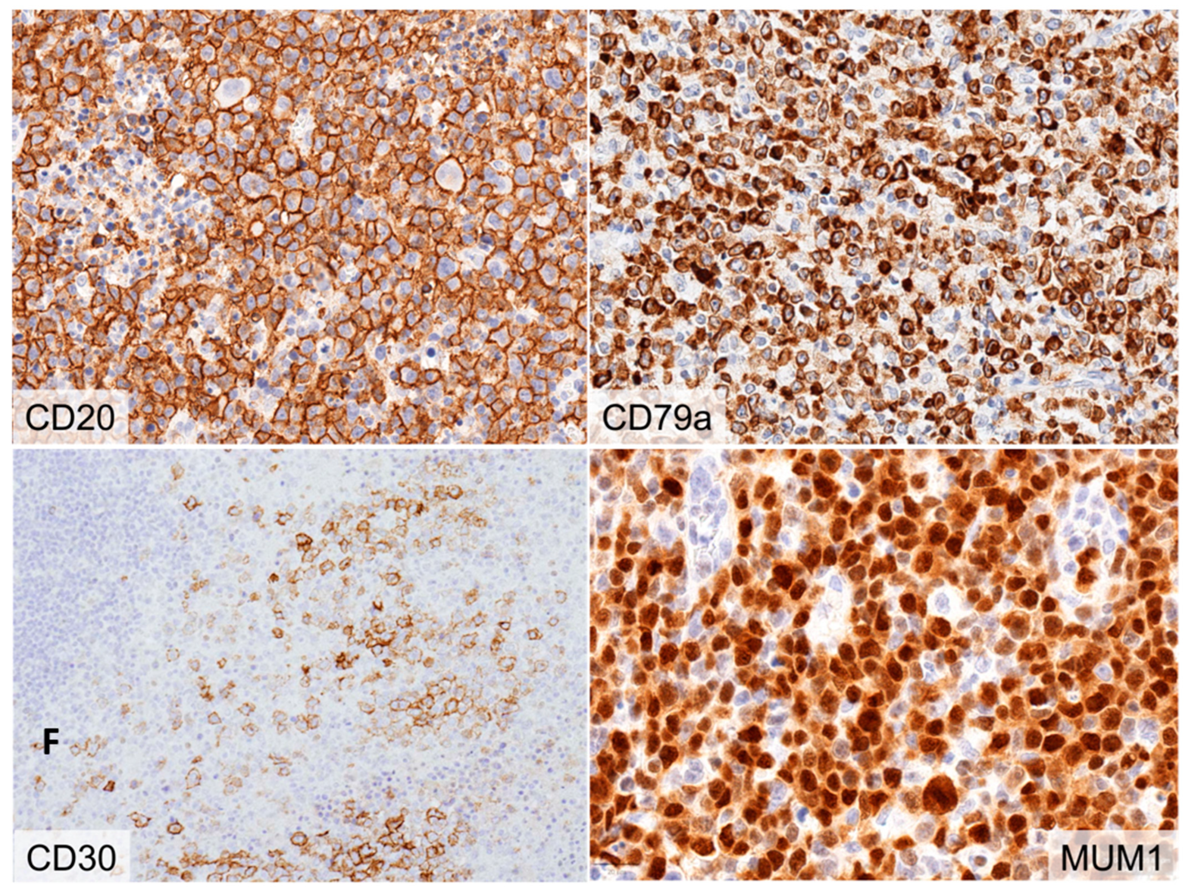 Hemato 05 00026 g003b