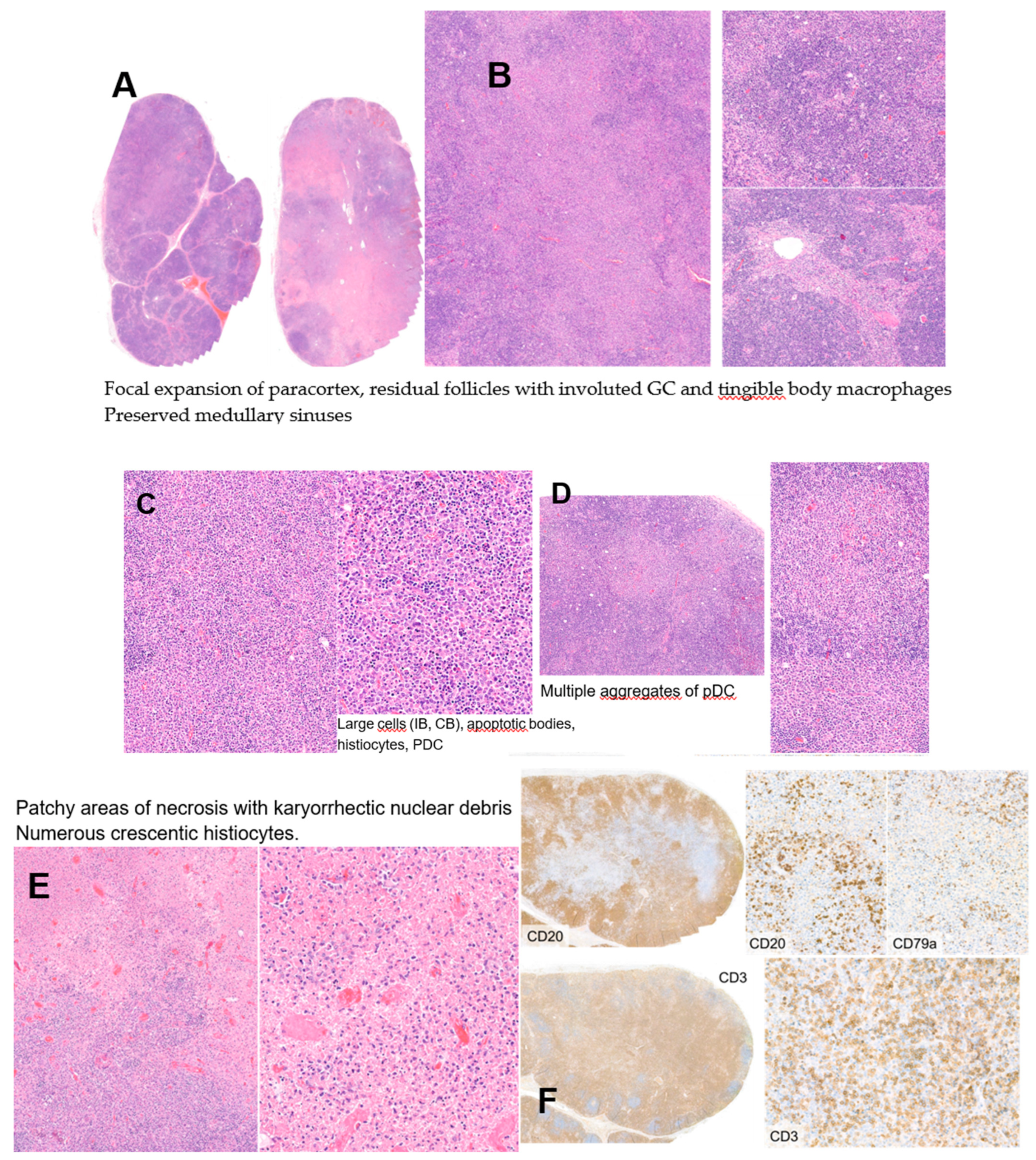 Hemato 05 00026 g004a