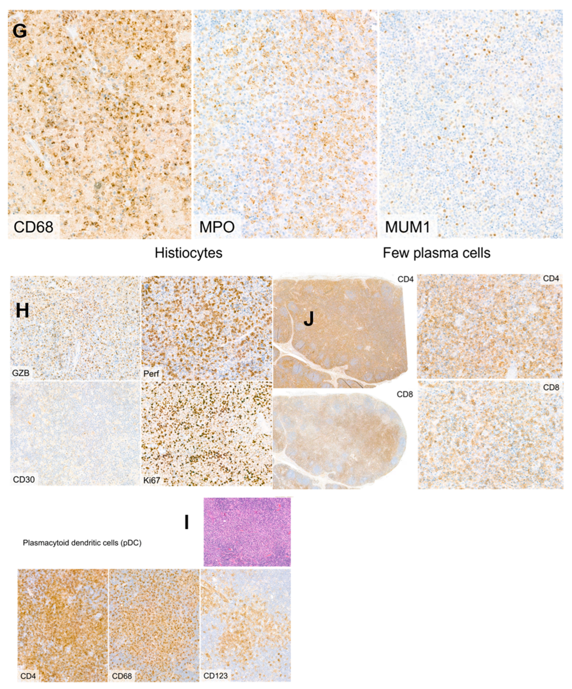 Hemato 05 00026 g004b