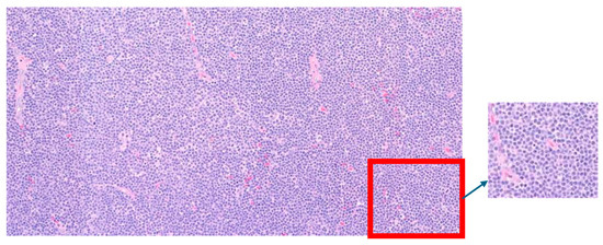 Hemato 05 00026 g005